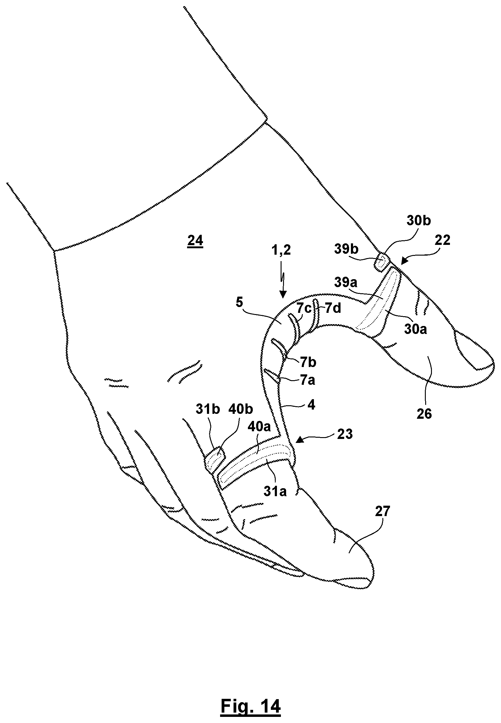 Patent US12310872 Figure 11 – Thumb orthosis and set of a plurality of thumb orthoses
