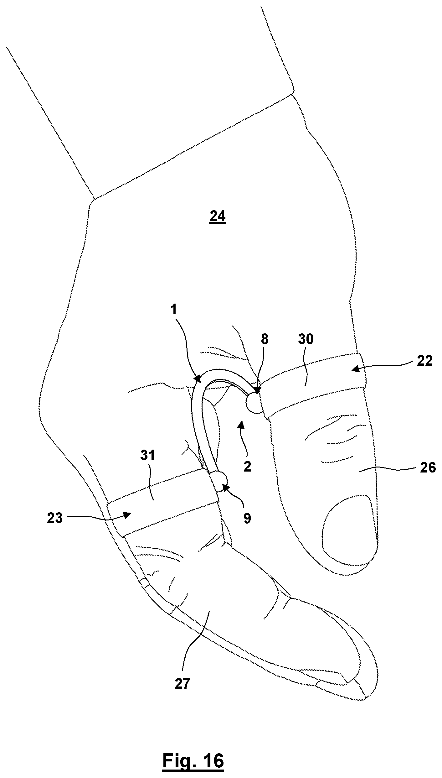 Patent US12310872 Figure 13 – Thumb orthosis and set of a plurality of thumb orthoses