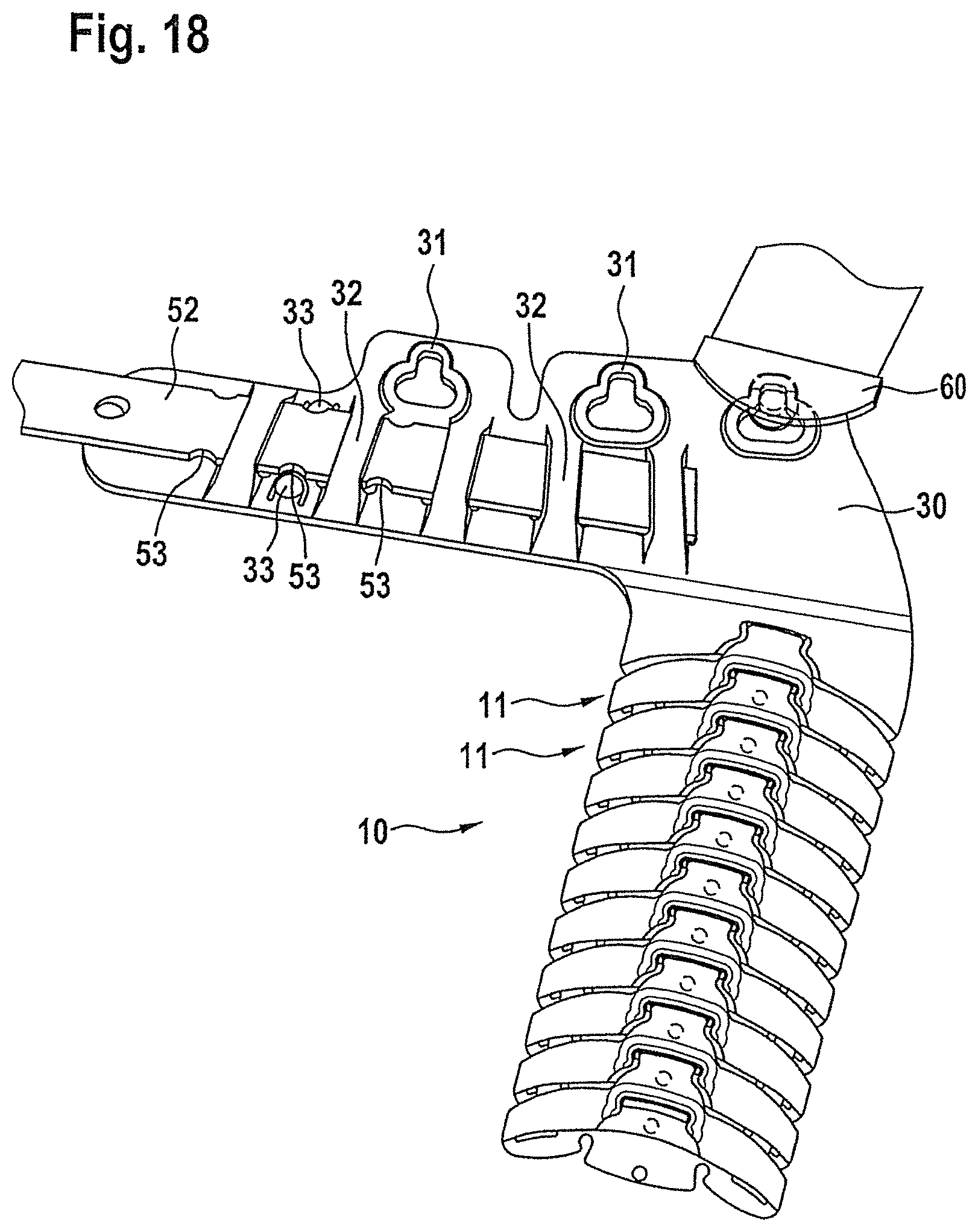 Patent US12310873 Figure 9 – Flexible support element for an orthosis