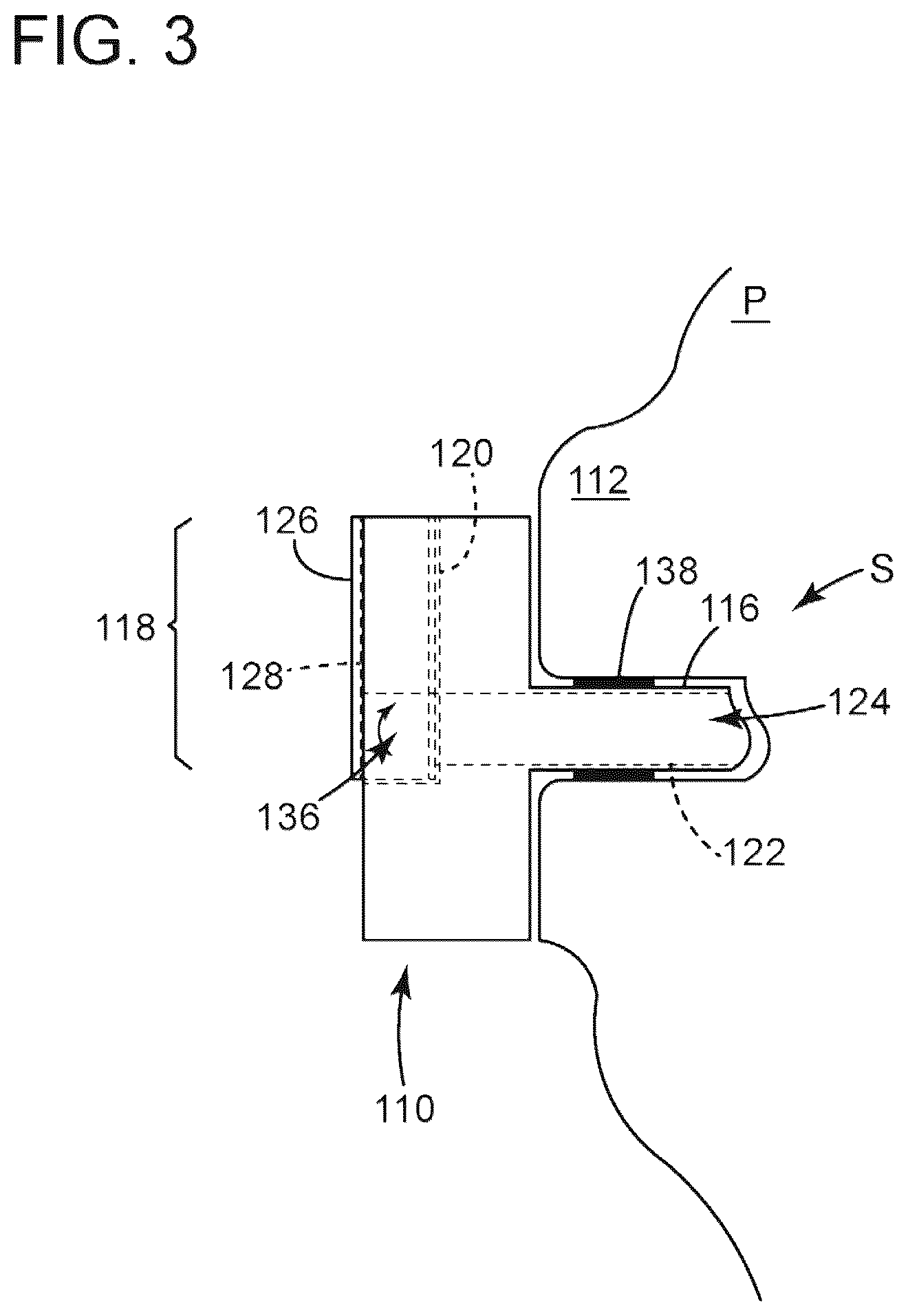 Patent US12310880 Figure 3 – Devices, systems and methods for regulating flow from a stoma on a patient