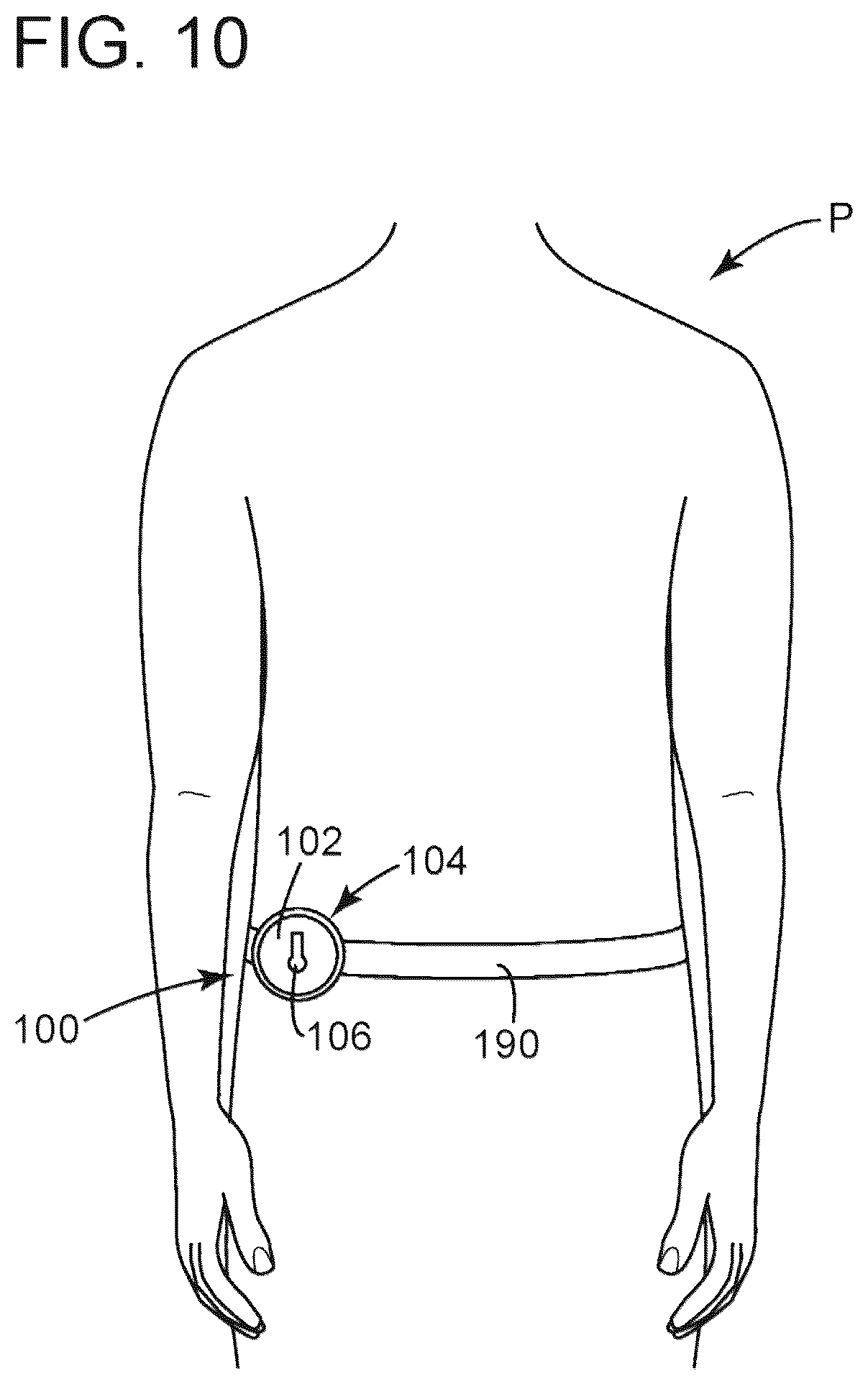 Patent US12310880 Figure 8 – Devices, systems and methods for regulating flow from a stoma on a patient