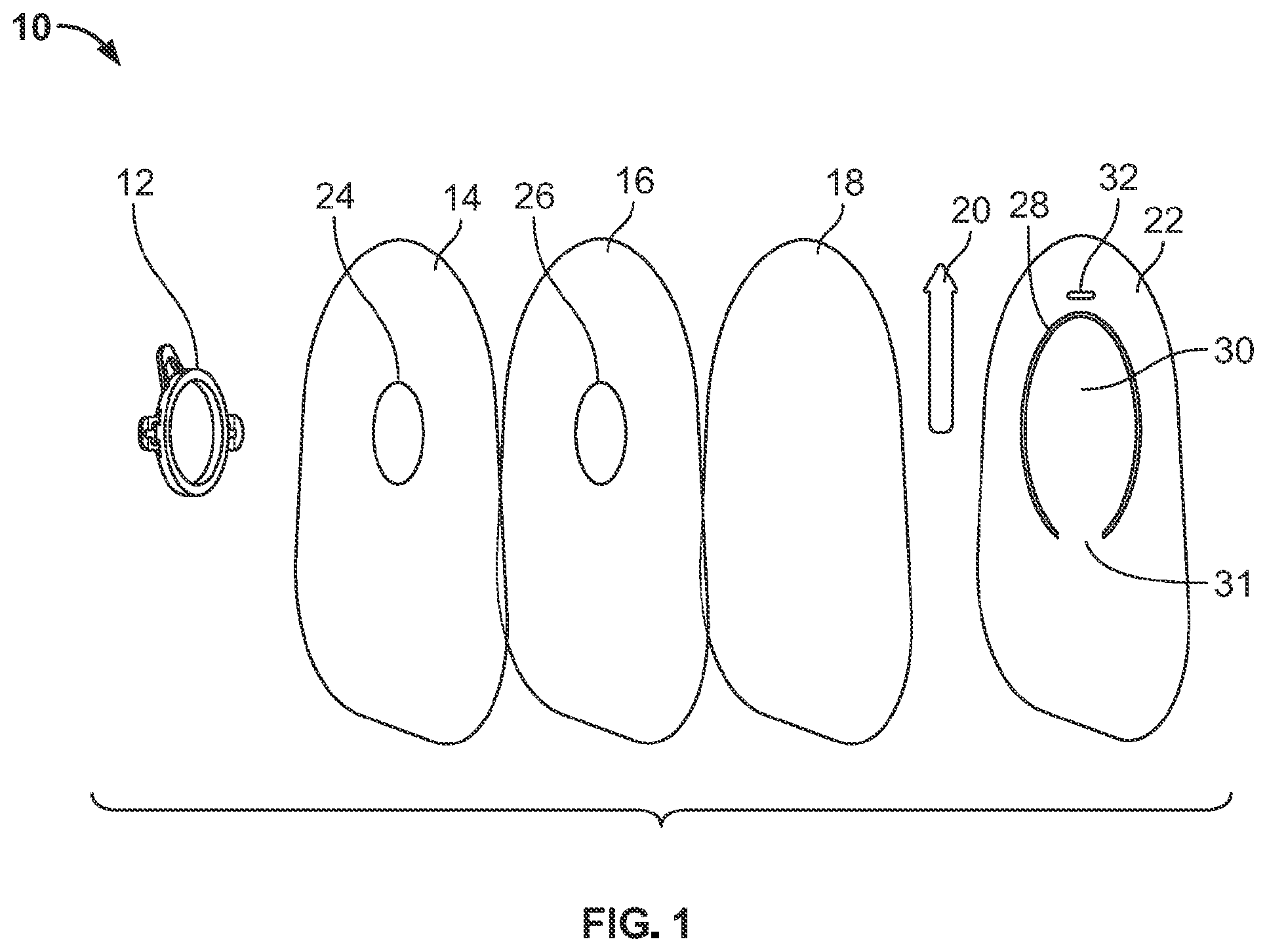 Patent US12310881 — Ostomy pouch with viewing option feature — Figure 1
