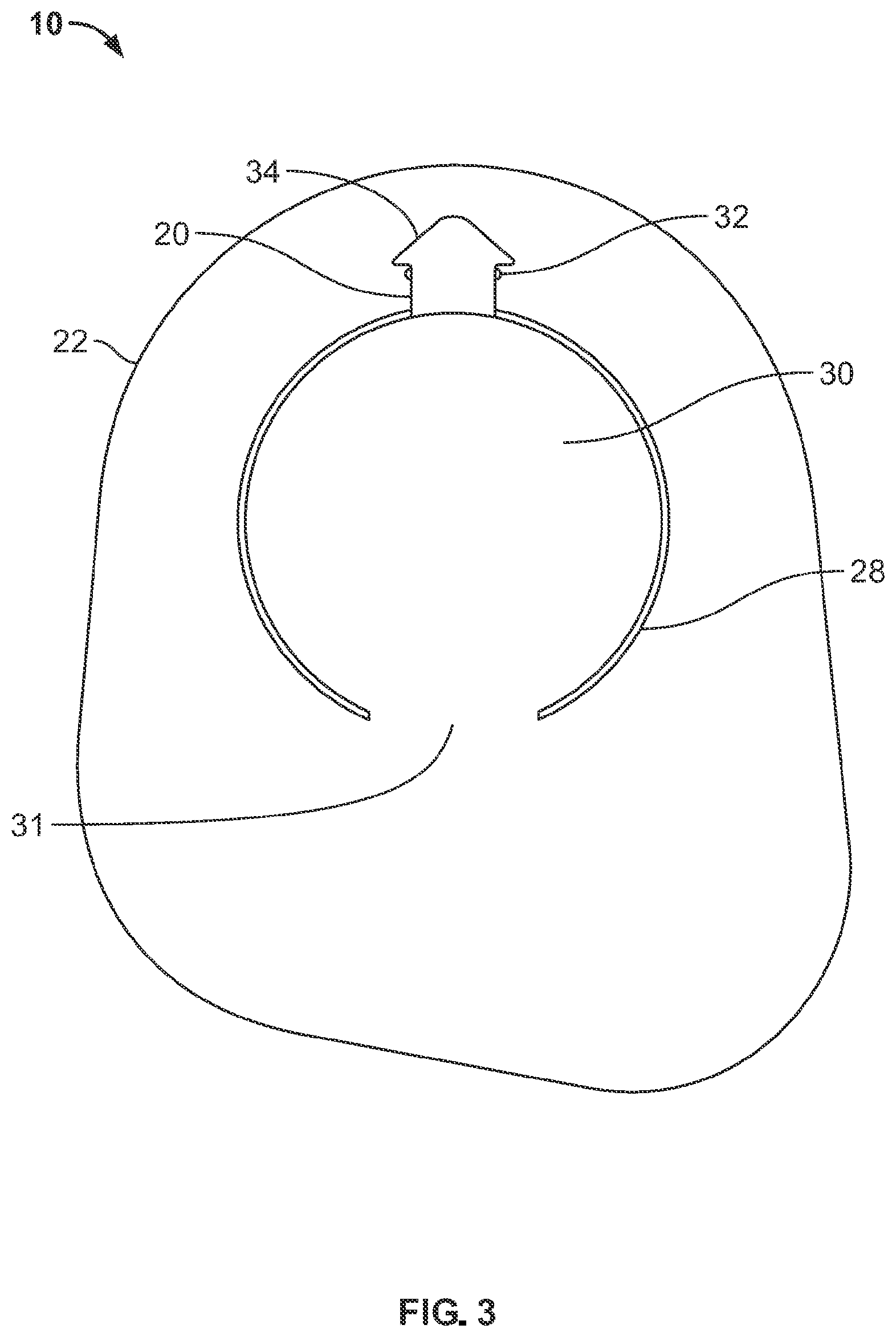 Patent US12310881 Figure 3 – Ostomy pouch with viewing option feature