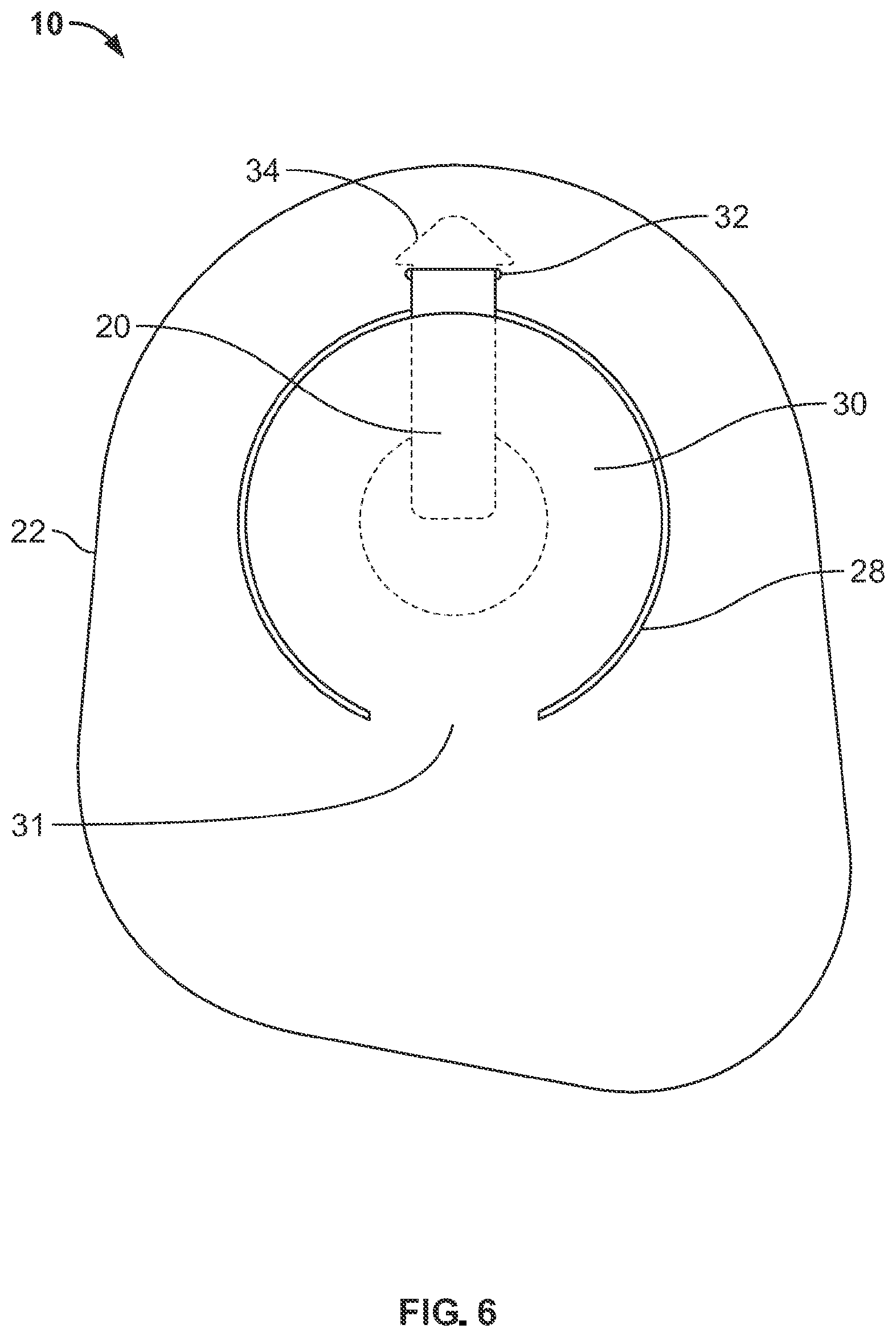 Patent US12310881 Figure 6 – Ostomy pouch with viewing option feature