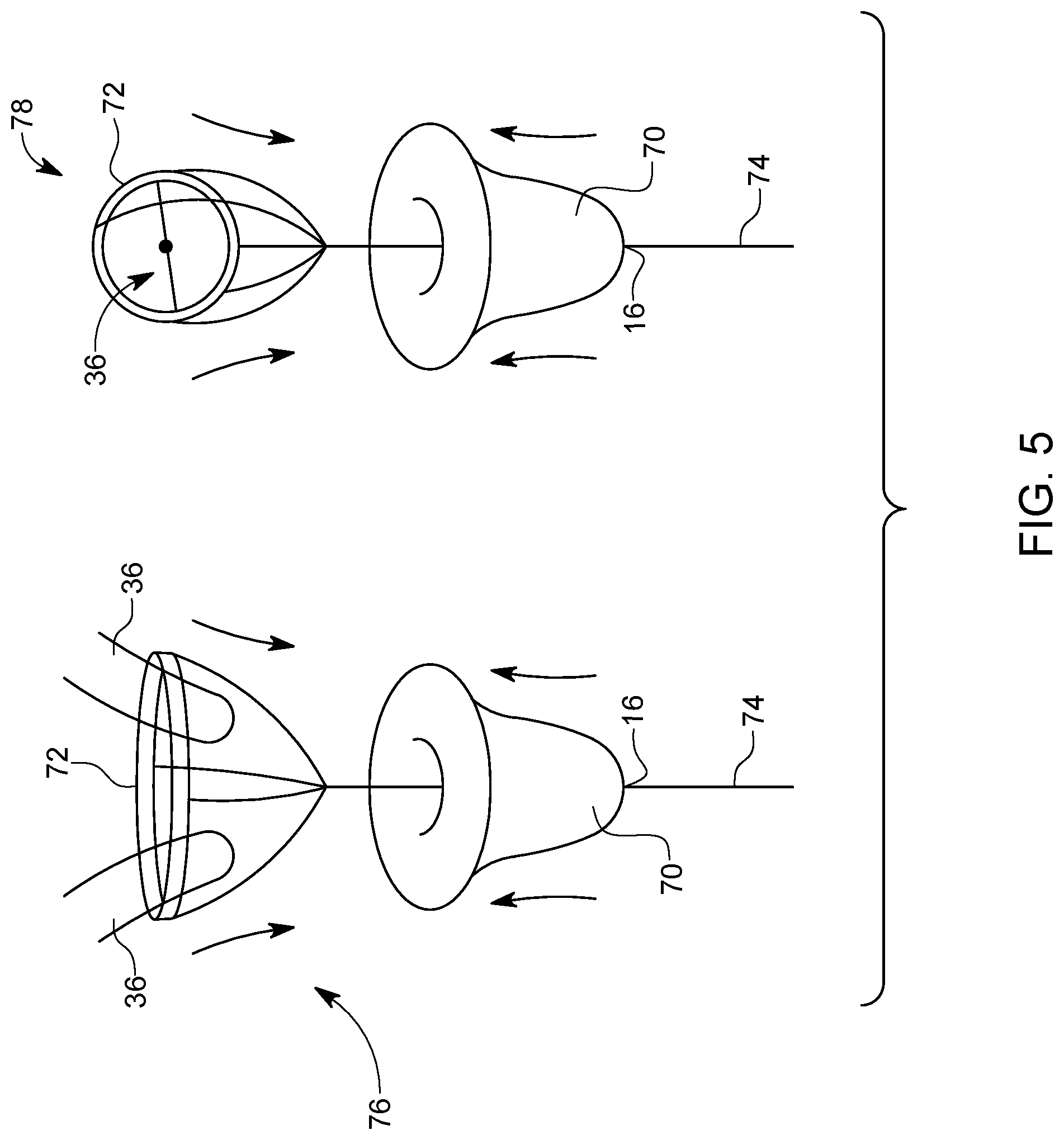 Patent US12310882 Figure 5 – Hannah cervical cup