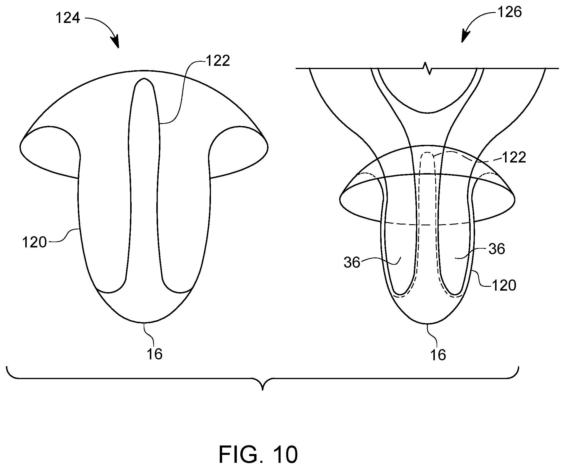 Patent US12310882 Figure 10 – Hannah cervical cup
