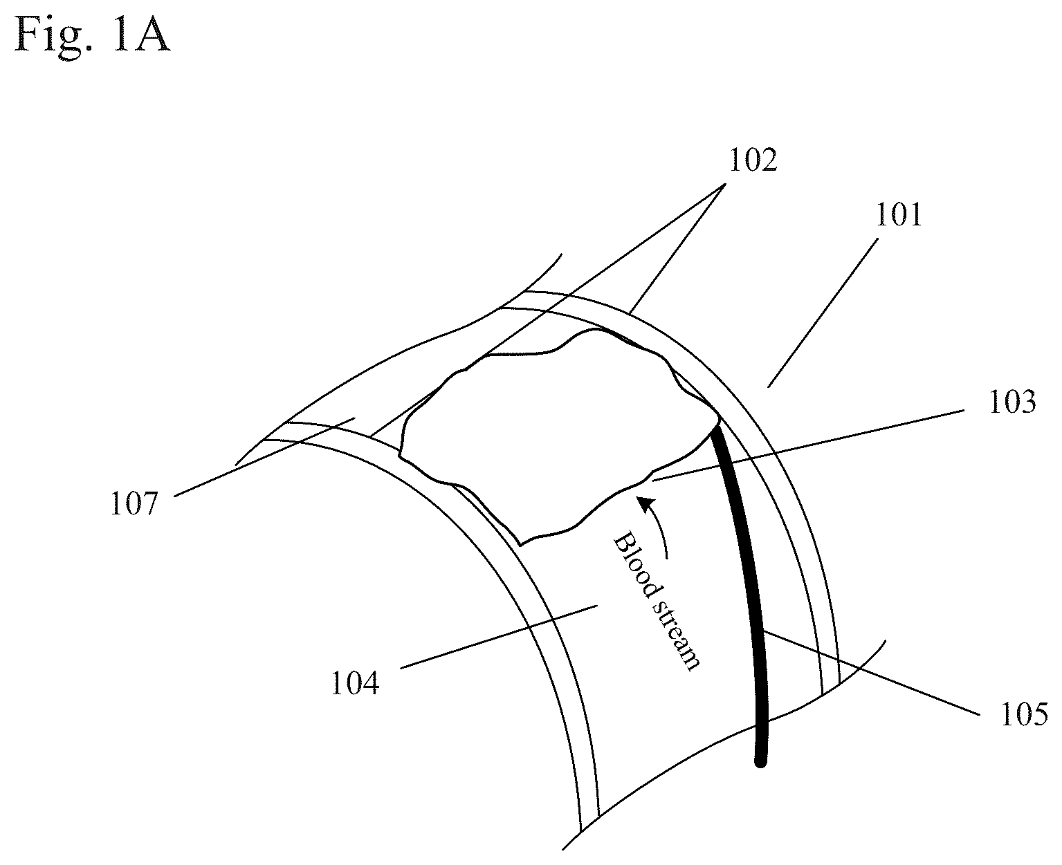 Patent US12310884 Figure 1 – Therapeutic organ cooling