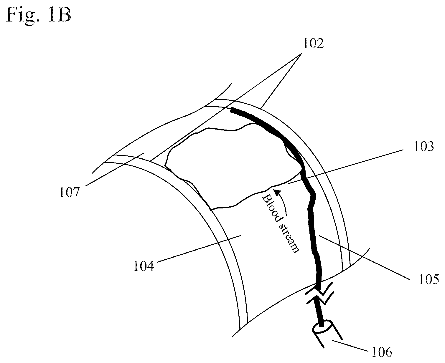 Patent US12310884 Figure 2 – Therapeutic organ cooling
