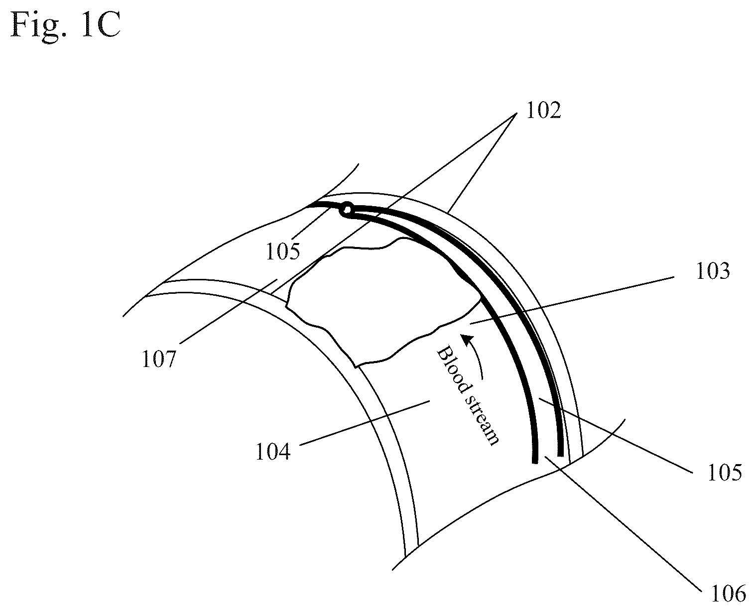 Patent US12310884 Figure 3 – Therapeutic organ cooling