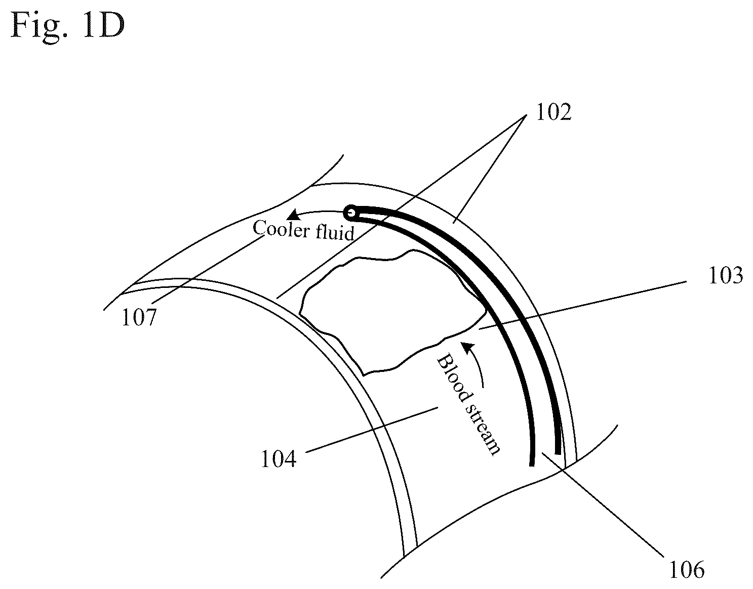 Patent US12310884 Figure 4 – Therapeutic organ cooling