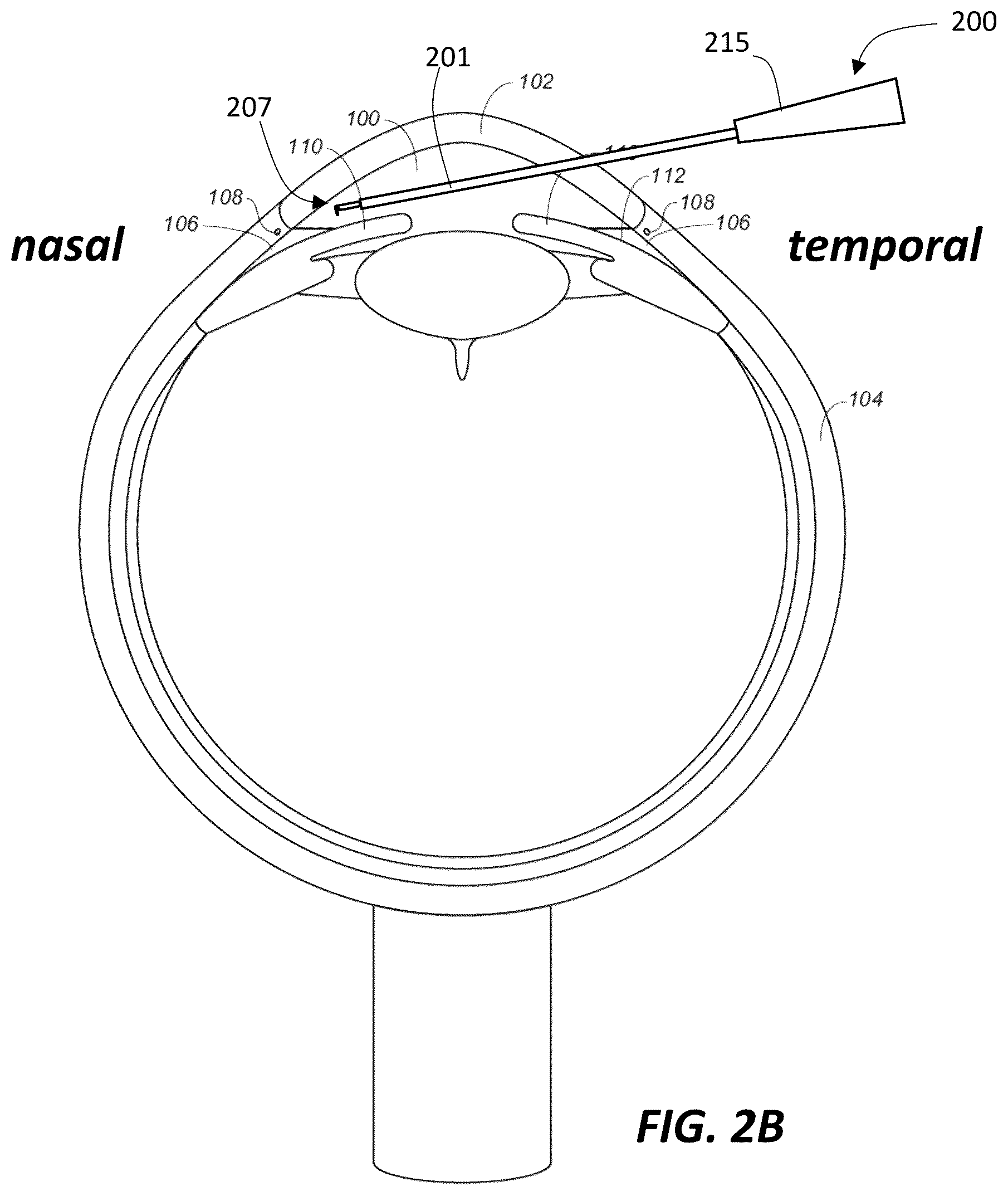 Patent US12310891 Figure 3 – Devices and methods for intraocular tissue manipulation