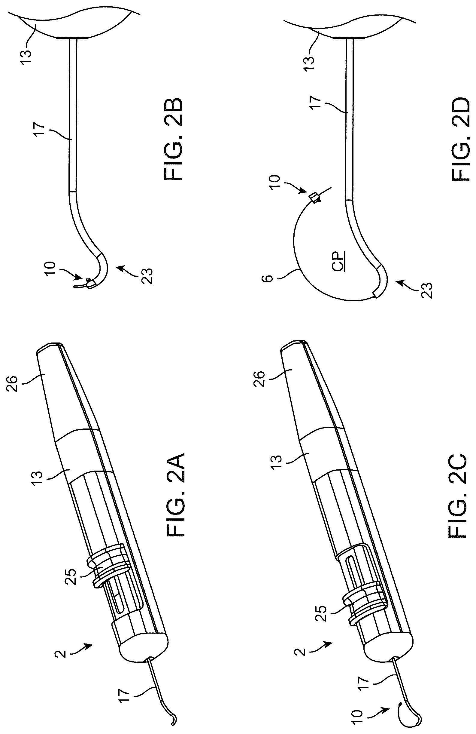 Patent US12310892 Figure 2 – Methods and devices for increasing aqueous drainage of the eye
