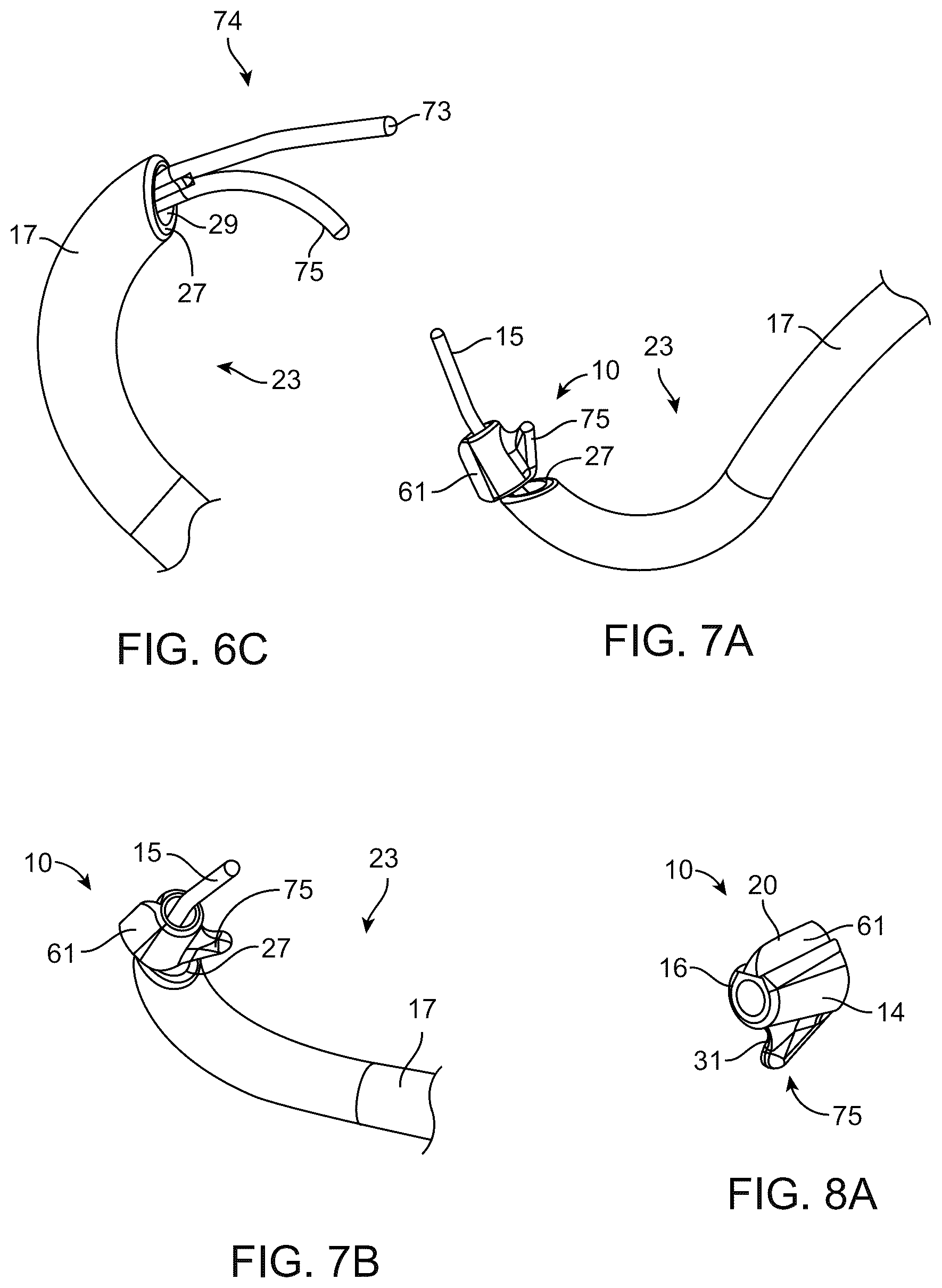 Patent US12310892 Figure 6 – Methods and devices for increasing aqueous drainage of the eye