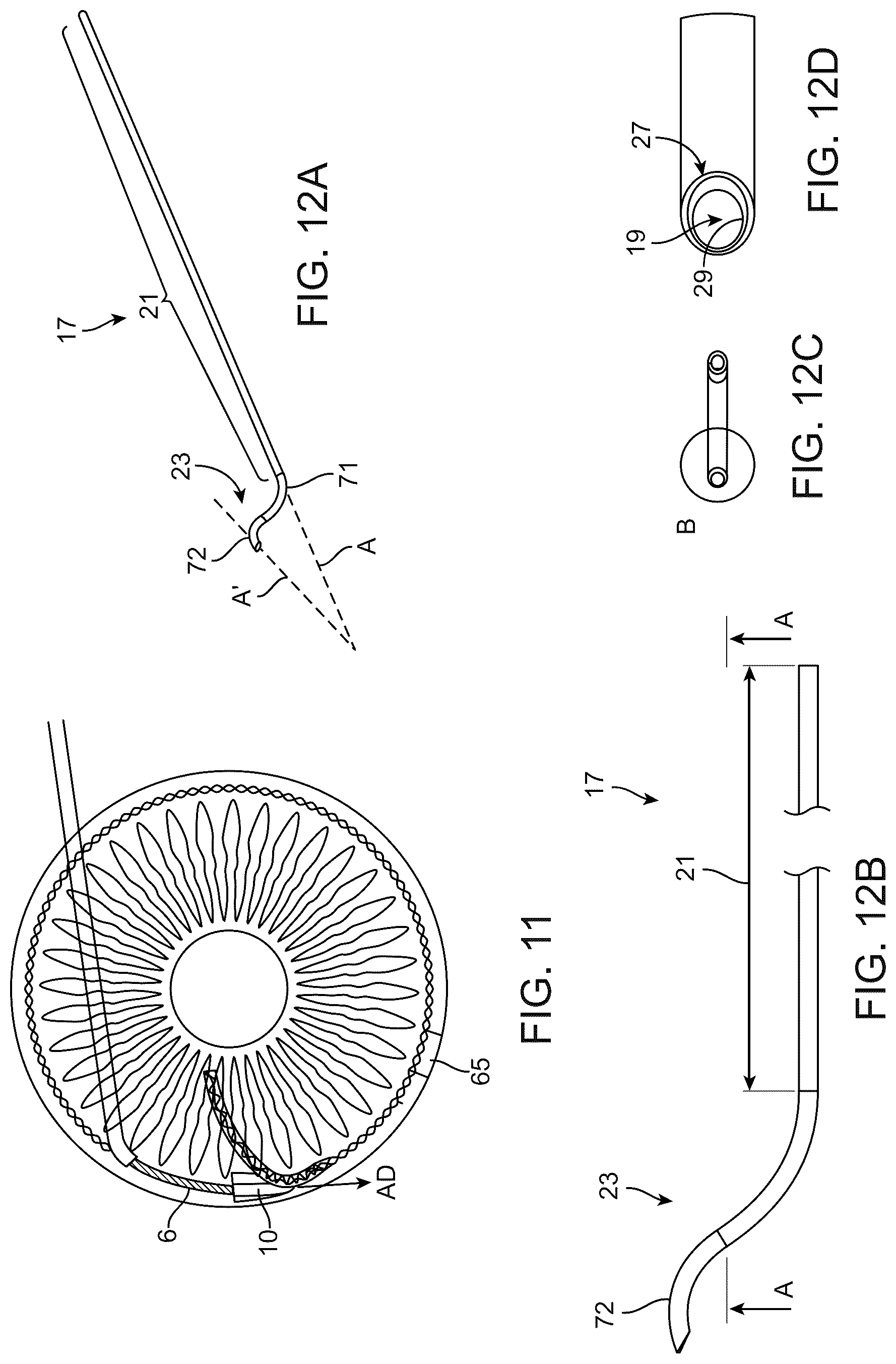 Patent US12310892 Figure 9 – Methods and devices for increasing aqueous drainage of the eye