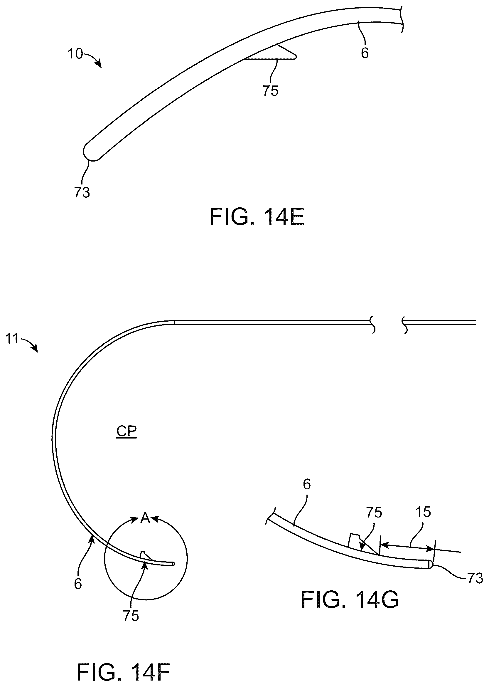 Patent US12310892 Figure 12 – Methods and devices for increasing aqueous drainage of the eye