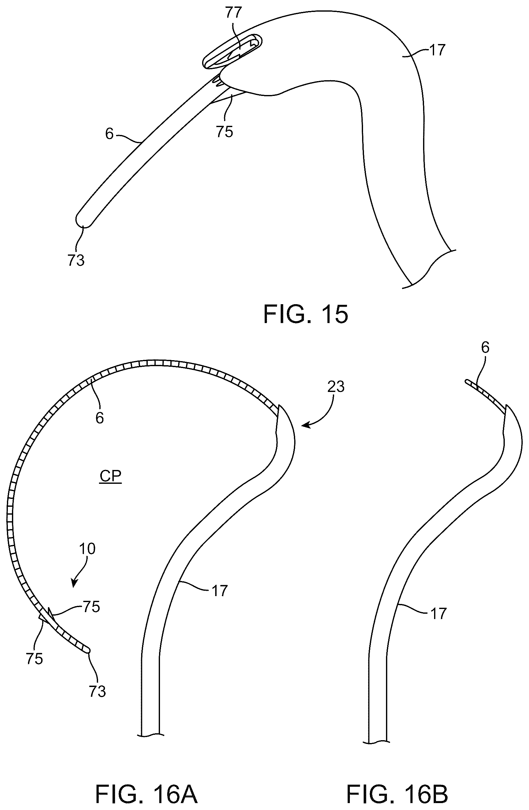 Patent US12310892 Figure 13 – Methods and devices for increasing aqueous drainage of the eye