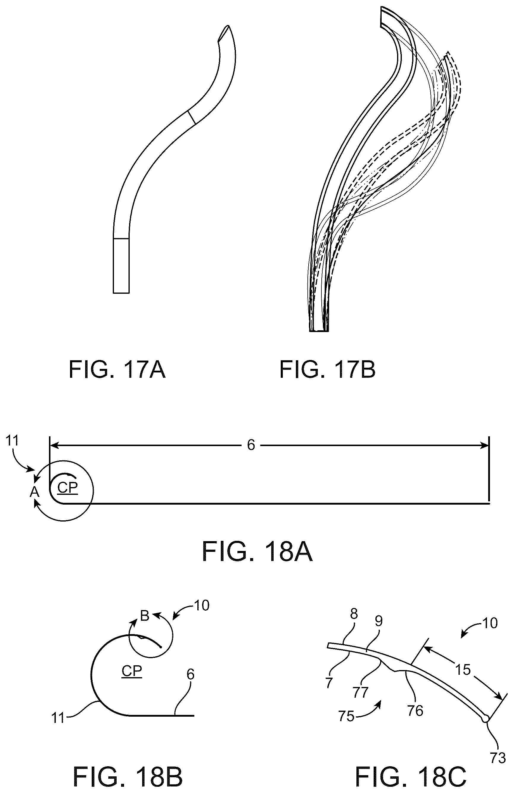Patent US12310892 Figure 15 – Methods and devices for increasing aqueous drainage of the eye