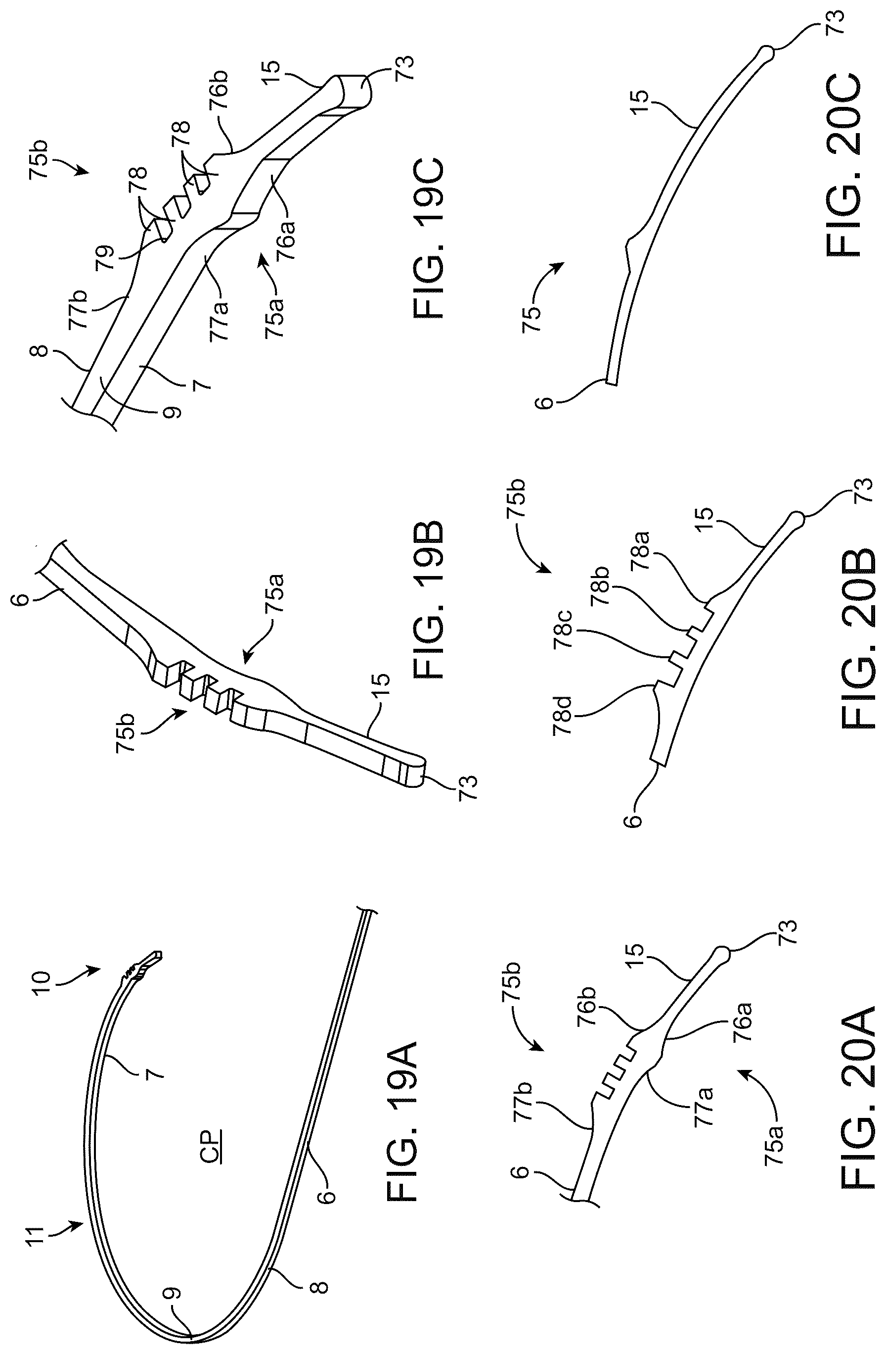 Patent US12310892 Figure 16 – Methods and devices for increasing aqueous drainage of the eye