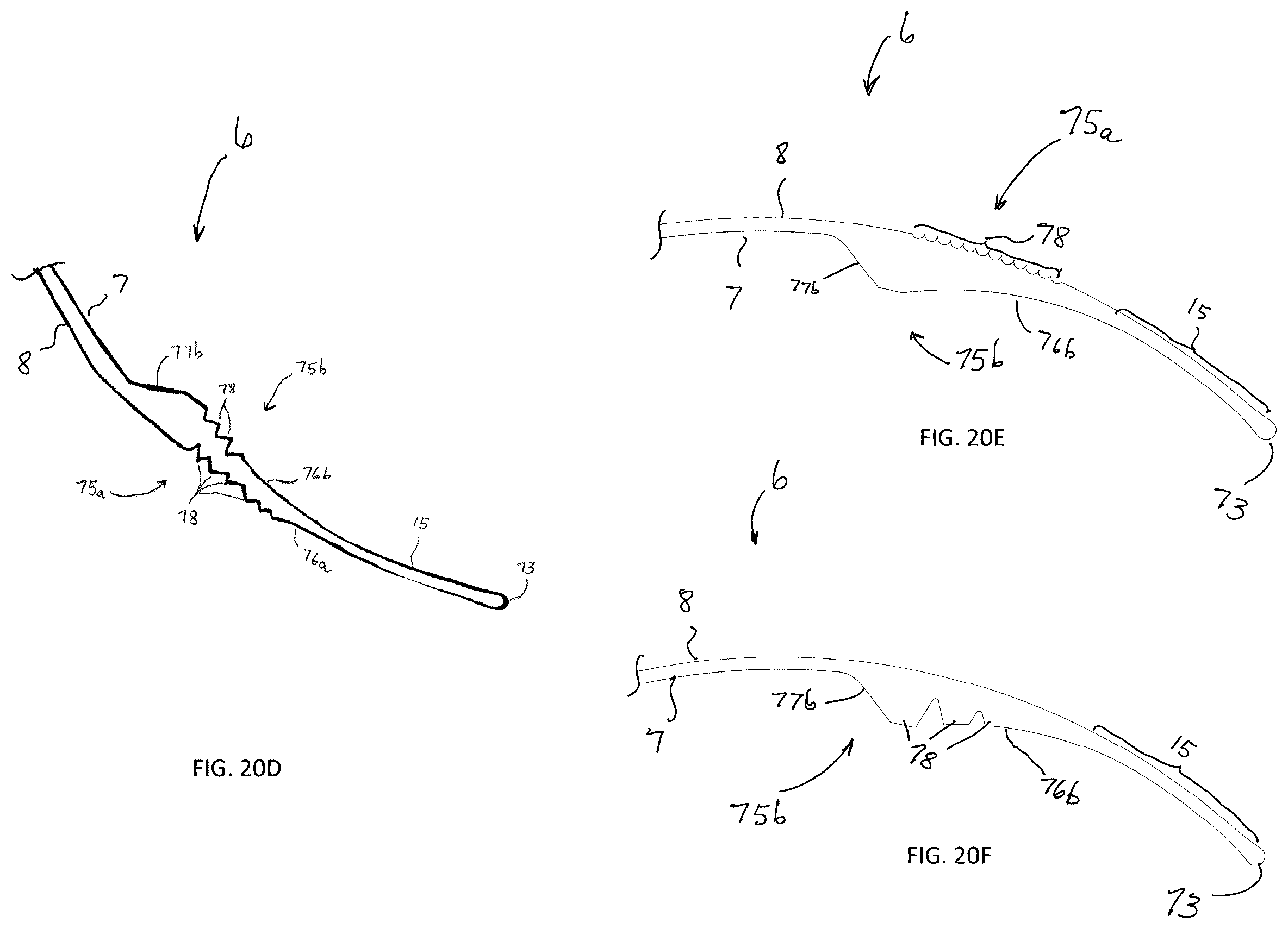 Patent US12310892 Figure 17 – Methods and devices for increasing aqueous drainage of the eye