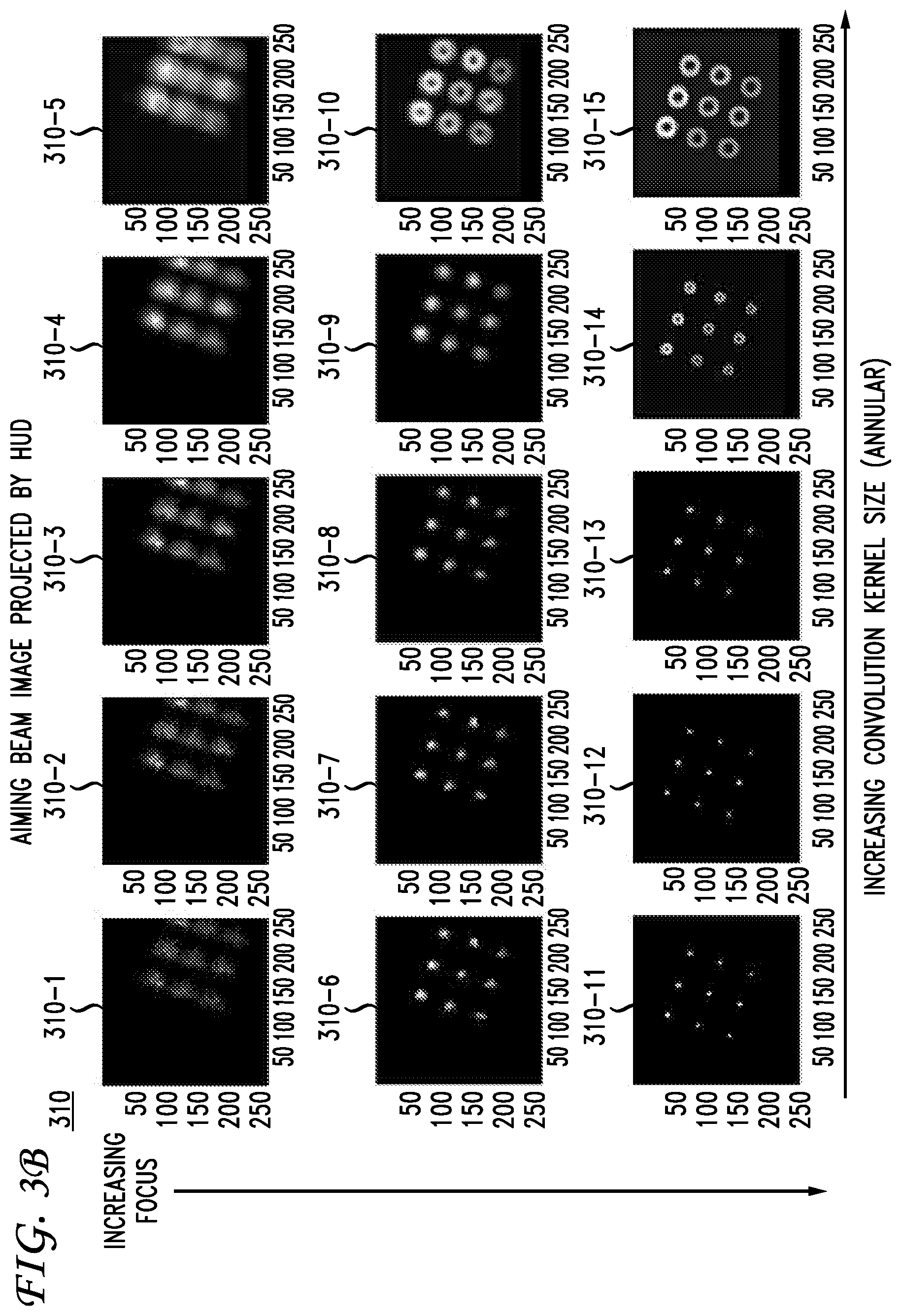 Patent US12310893 Figure 4 – System and method for a patient-invisible laser treatment alignment pattern in ophthalmic photomedicine