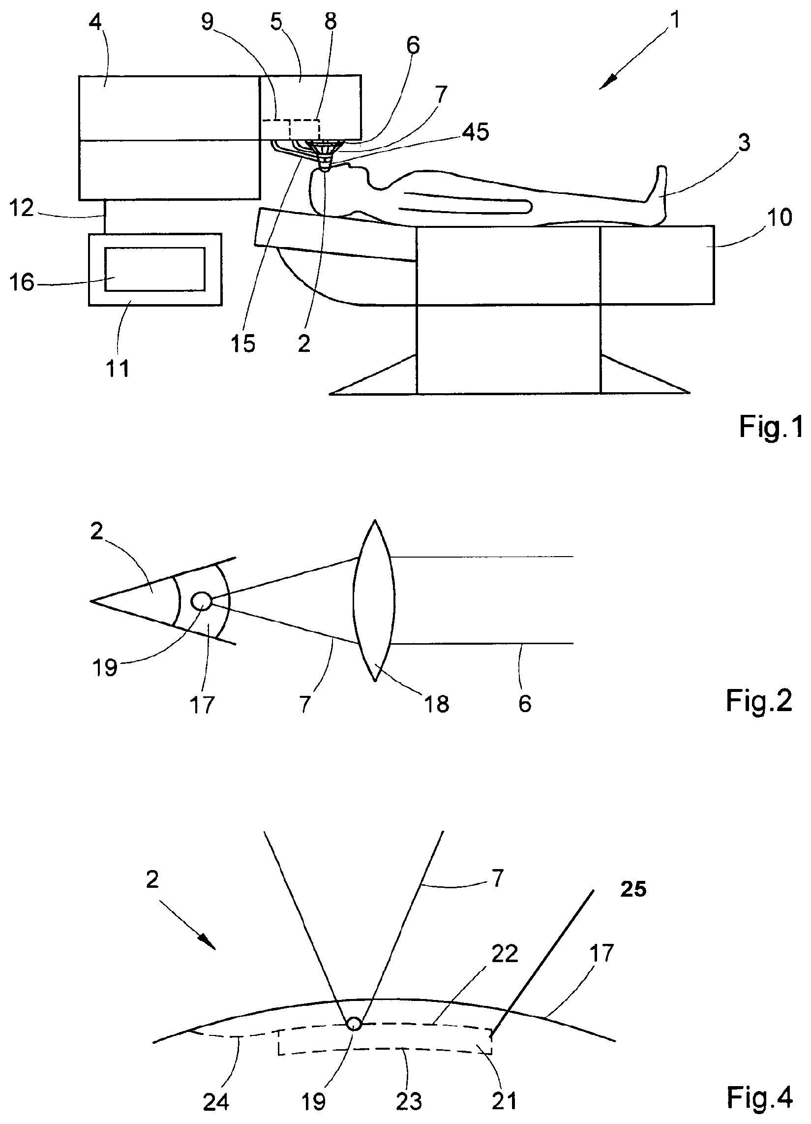 Patent US12310894 — Post-treatment in refraction correction during eye surgery — Figure 1