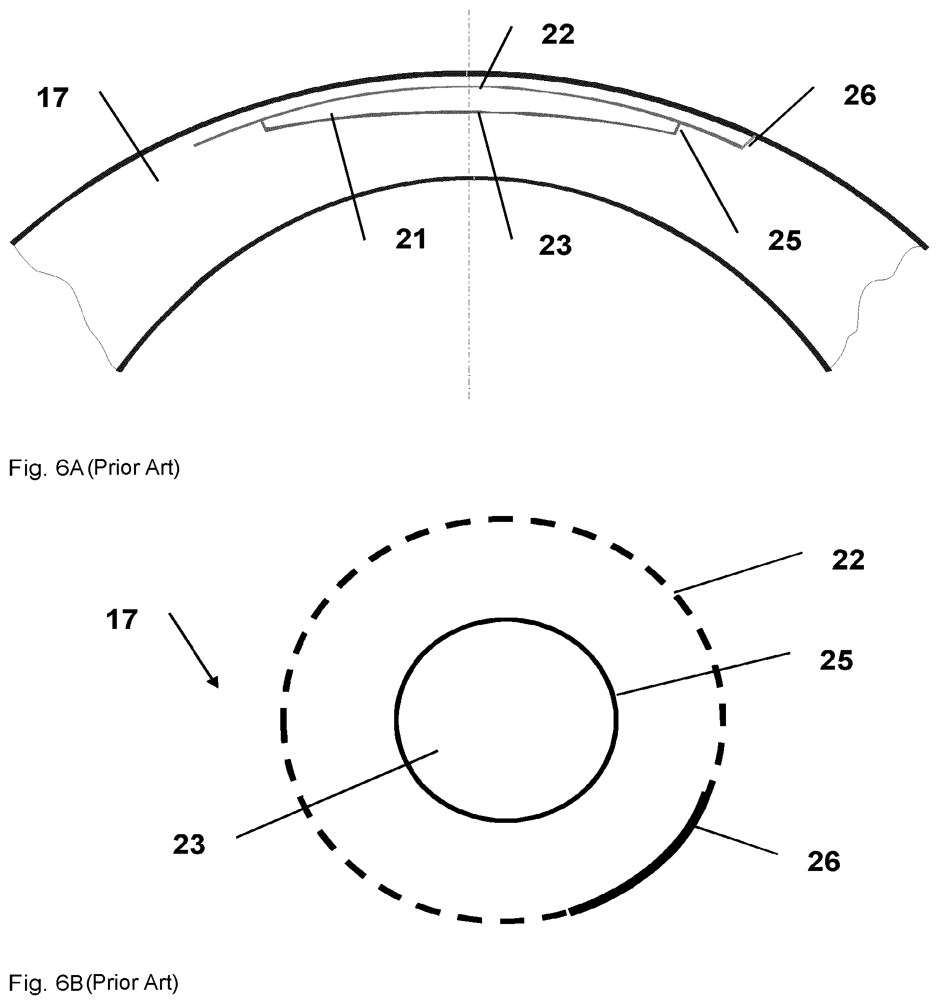Patent US12310894 Figure 3 – Post-treatment in refraction correction during eye surgery
