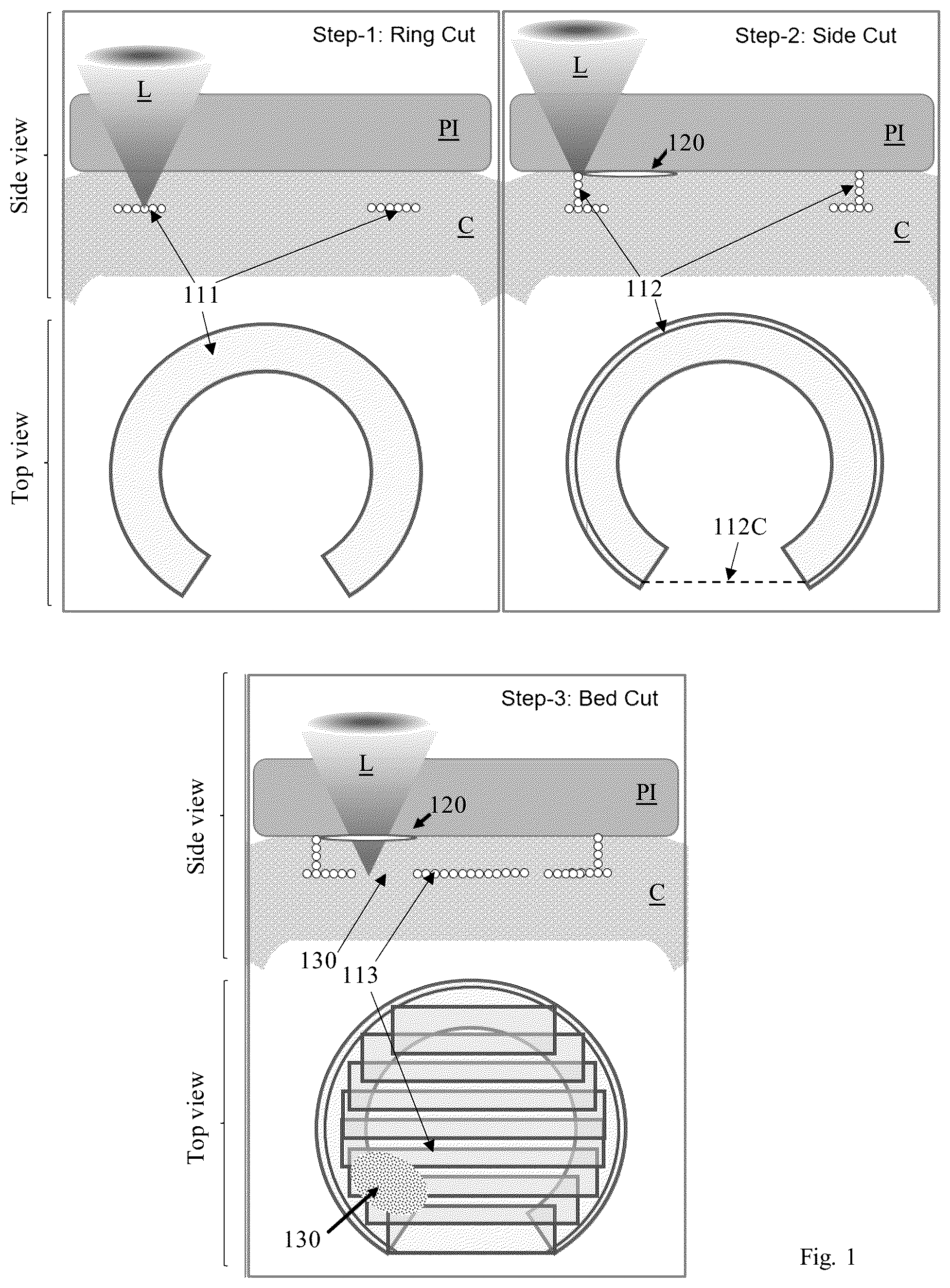 Patent US12310895 Figure 1 – Lasik flap cutting patterns including bubble barrier layer in side cut for bubble management