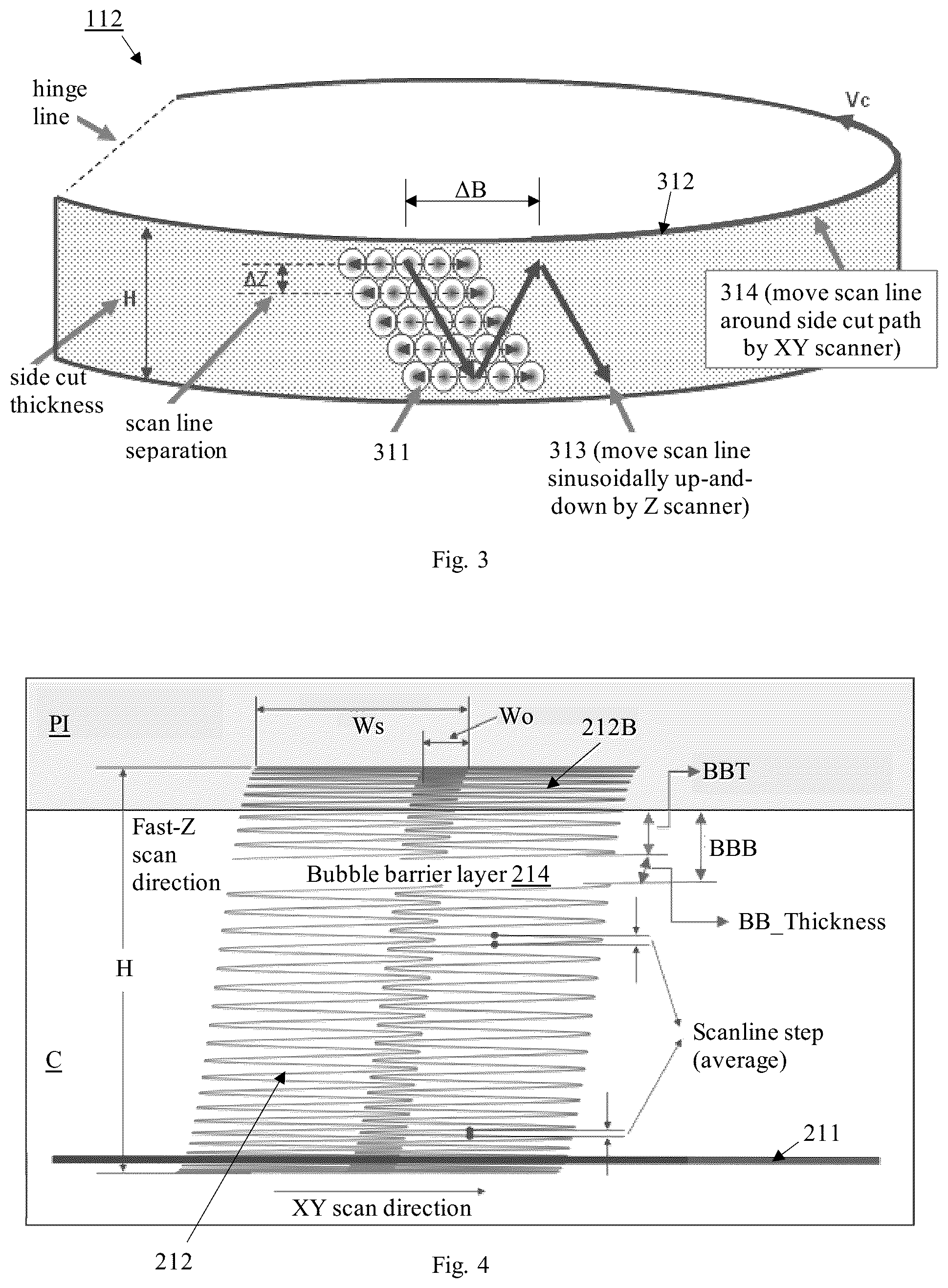 Patent US12310895 Figure 3 – Lasik flap cutting patterns including bubble barrier layer in side cut for bubble management