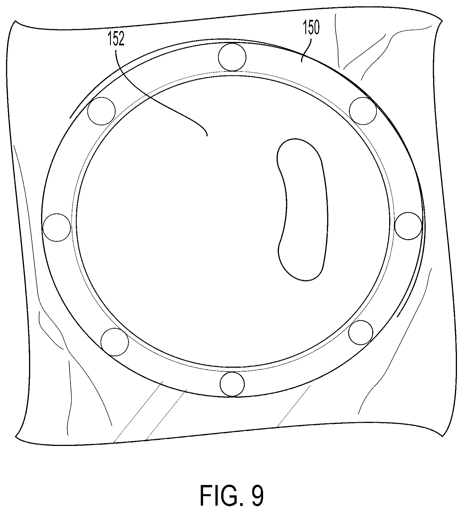 Patent US12310897 Figure 12 – Negative pressure aerosolization mitigation devices and methods