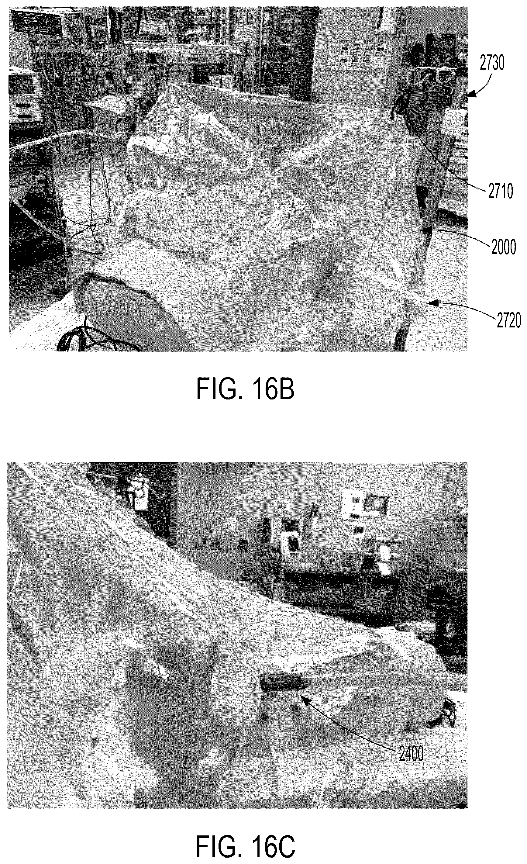 Patent US12310897 Figure 20 – Negative pressure aerosolization mitigation devices and methods