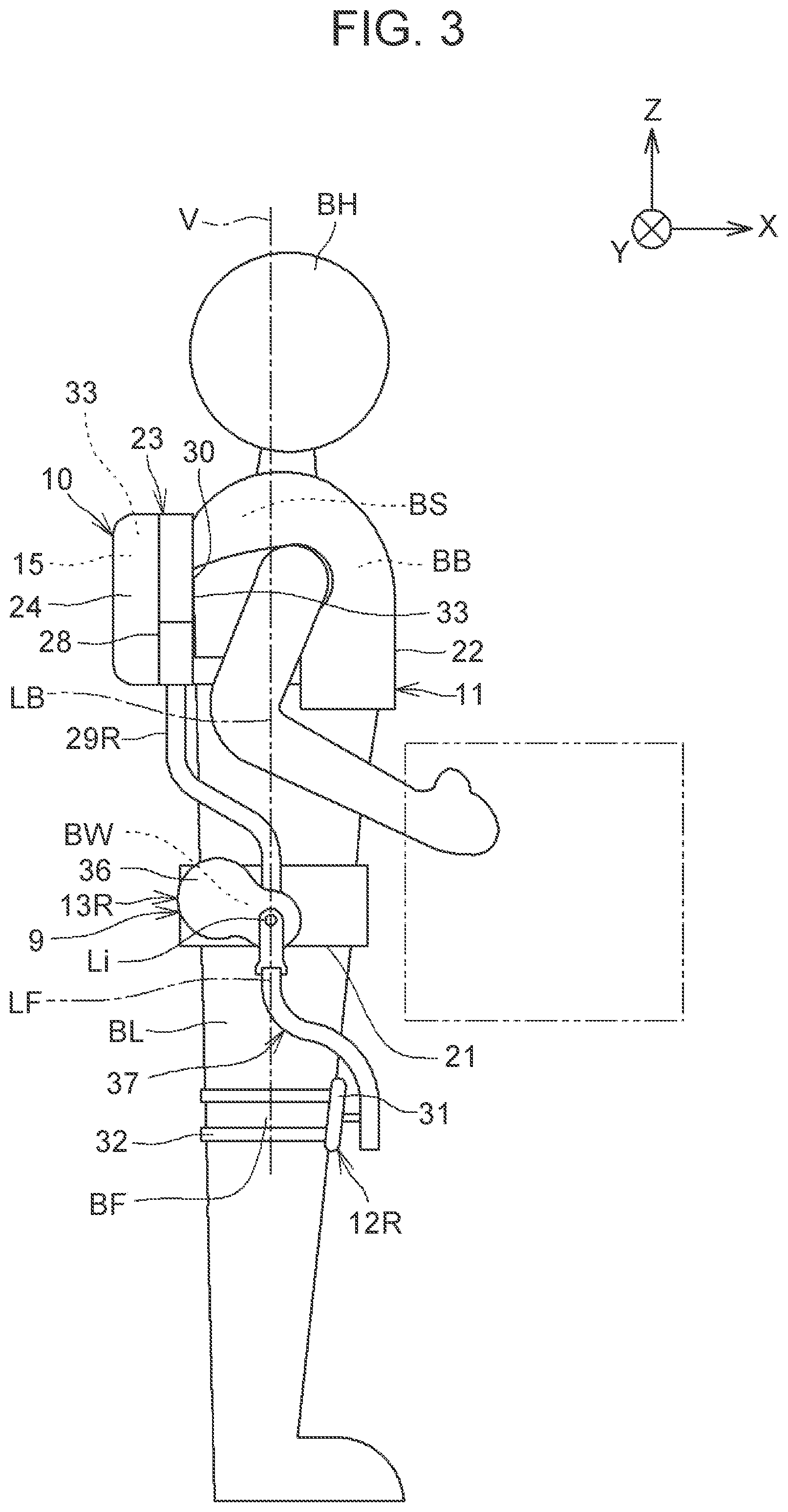 Patent US12310908 Figure 3 – Assist device