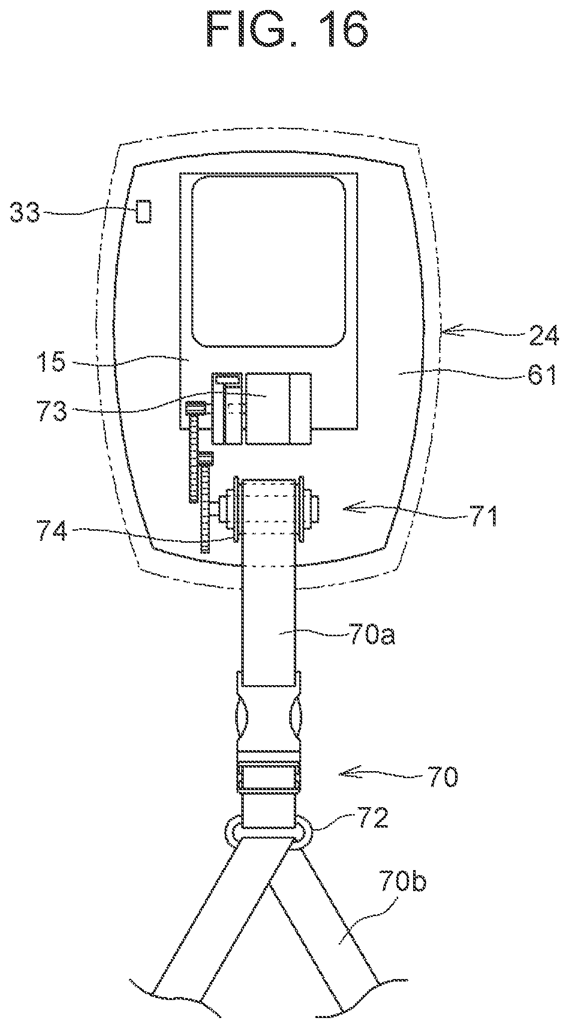 Patent US12310908 Figure 16 – Assist device
