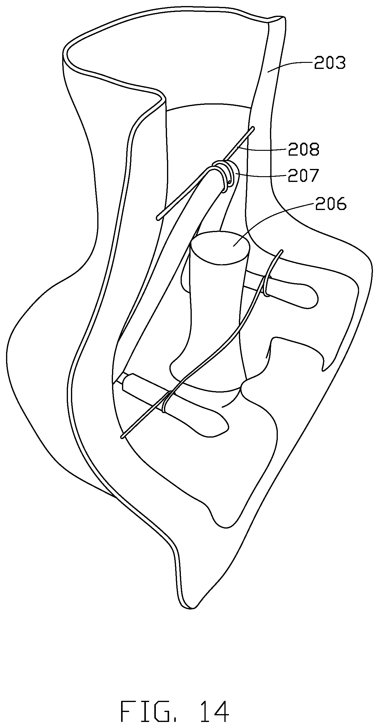Patent US12310911 Figure 13 – Auxiliary stimulating apparatus