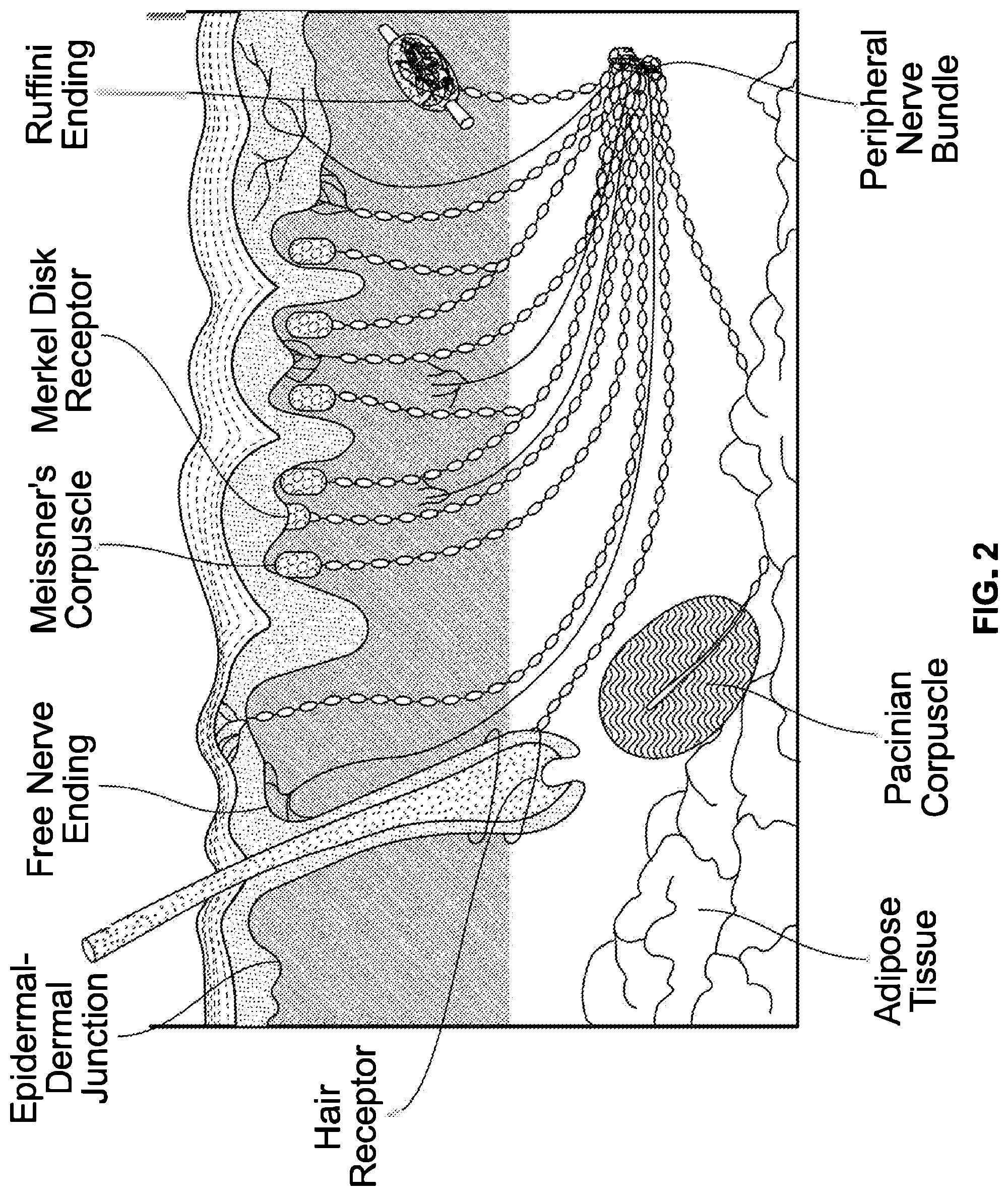 Patent US12310914 Figure 2 – Method and system of mechanical nerve stimulation for pain relief