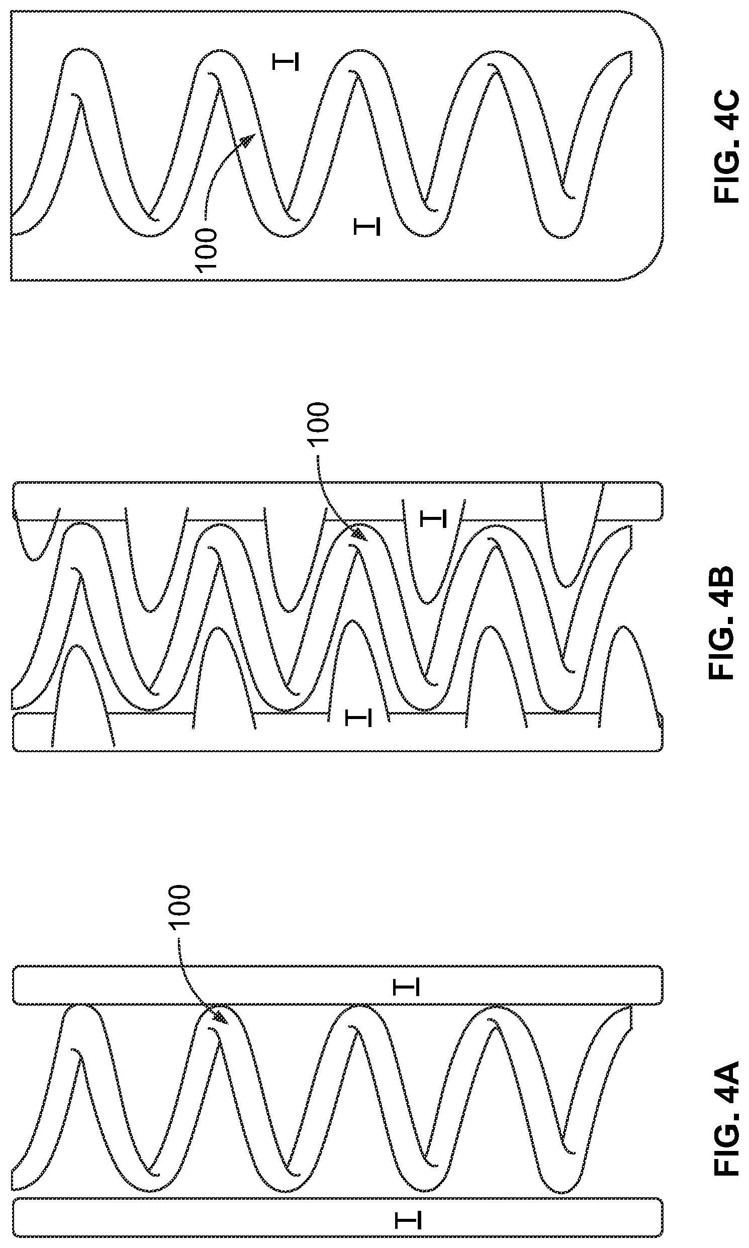 Patent US12310914 Figure 4 – Method and system of mechanical nerve stimulation for pain relief