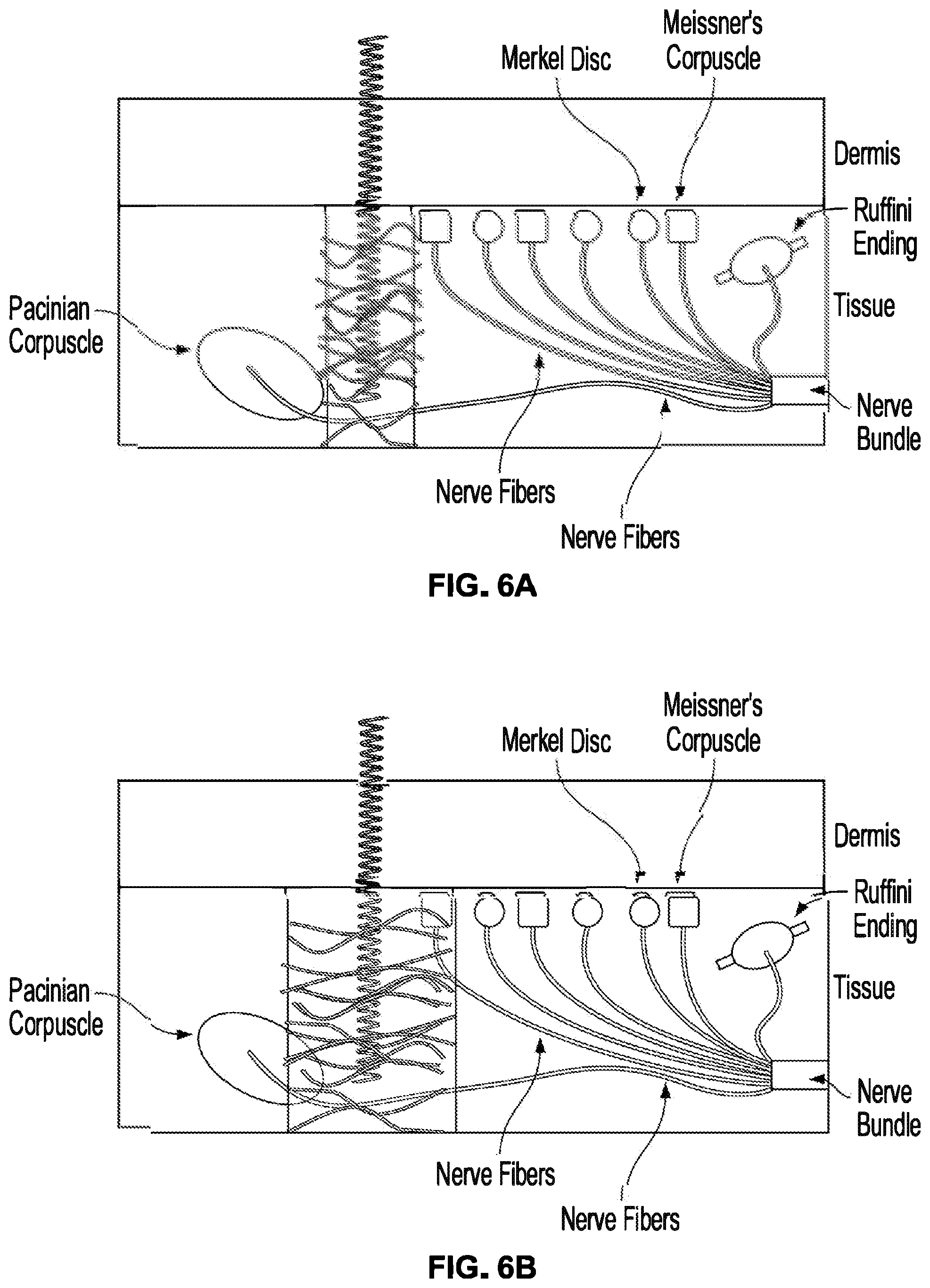 Patent US12310914 Figure 6 – Method and system of mechanical nerve stimulation for pain relief