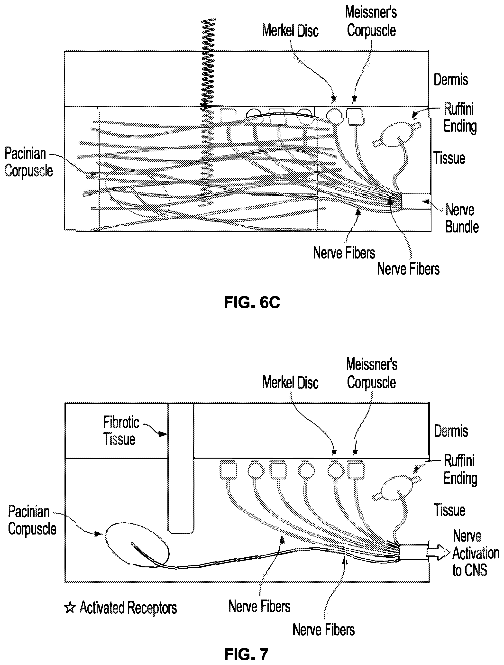 Patent US12310914 Figure 7 – Method and system of mechanical nerve stimulation for pain relief