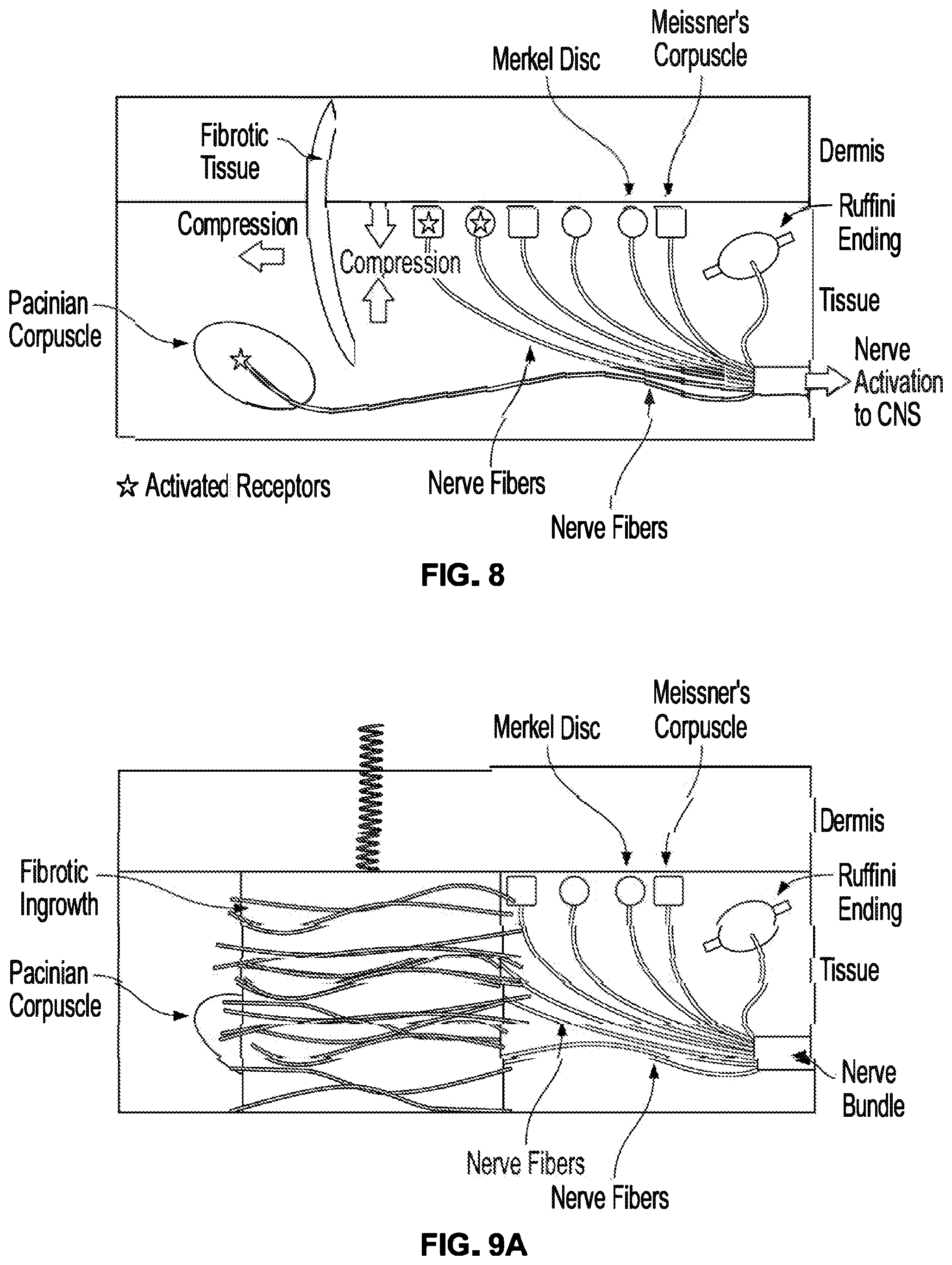 Patent US12310914 Figure 8 – Method and system of mechanical nerve stimulation for pain relief