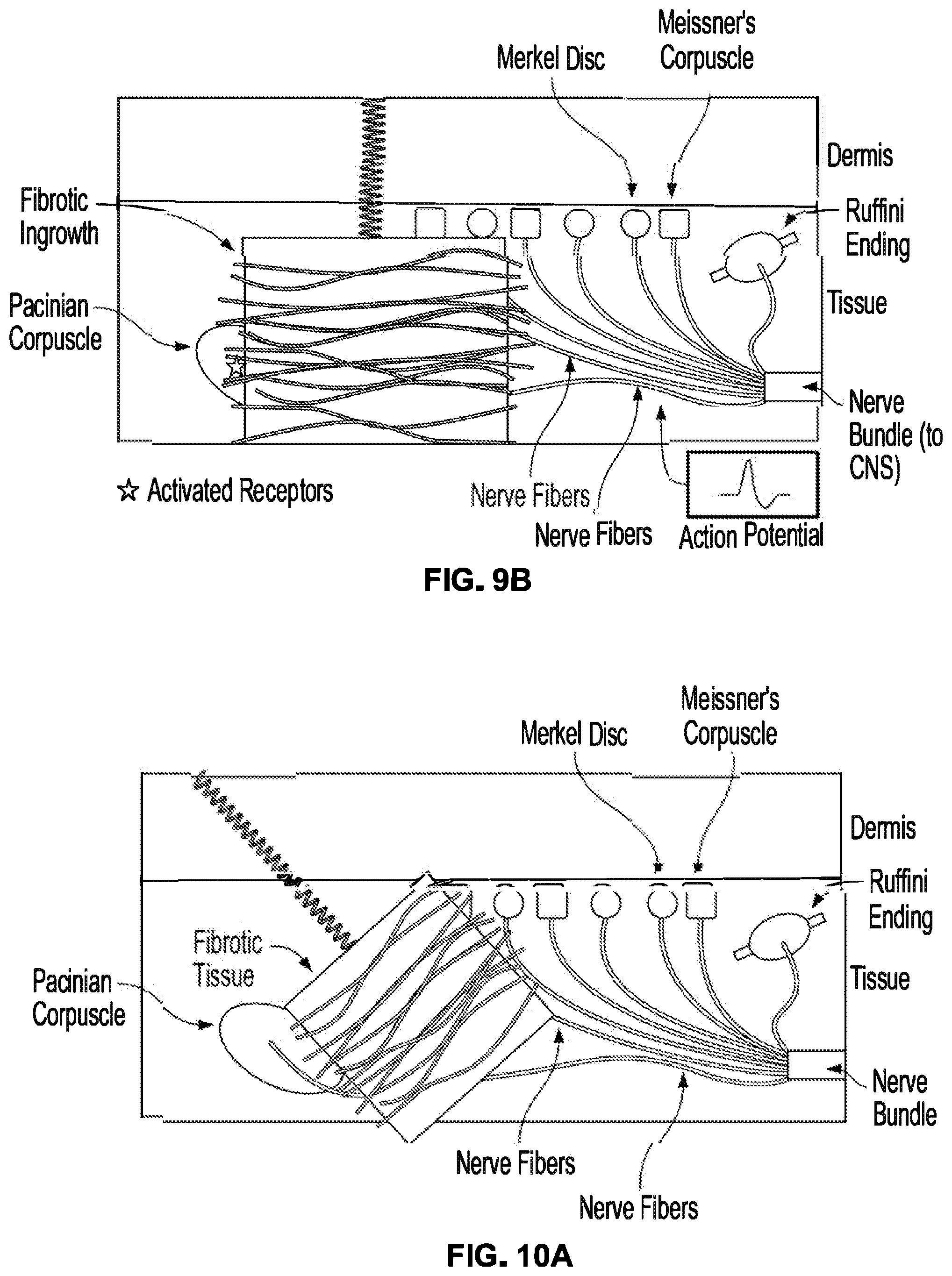 Patent US12310914 Figure 9 – Method and system of mechanical nerve stimulation for pain relief