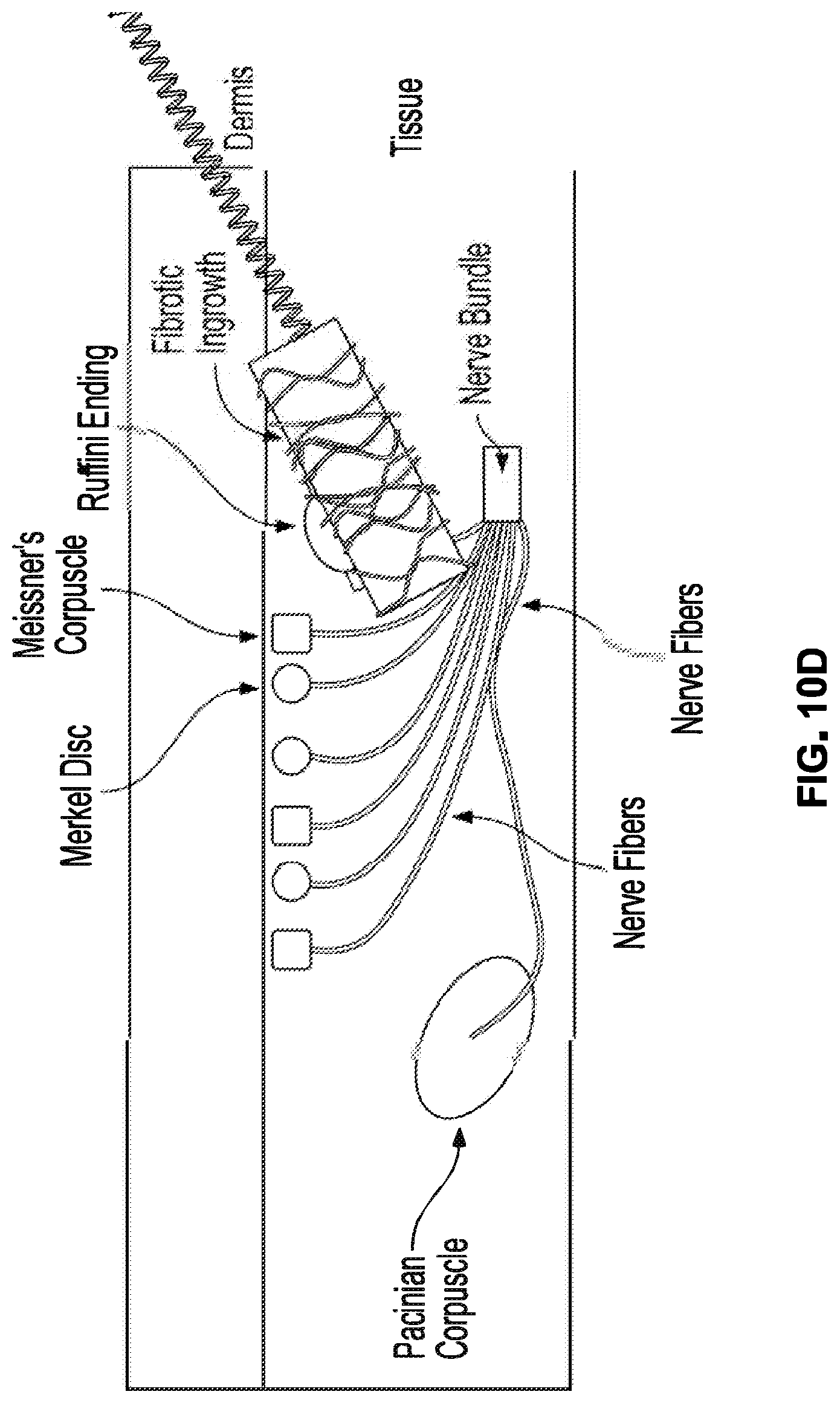 Patent US12310914 Figure 12 – Method and system of mechanical nerve stimulation for pain relief