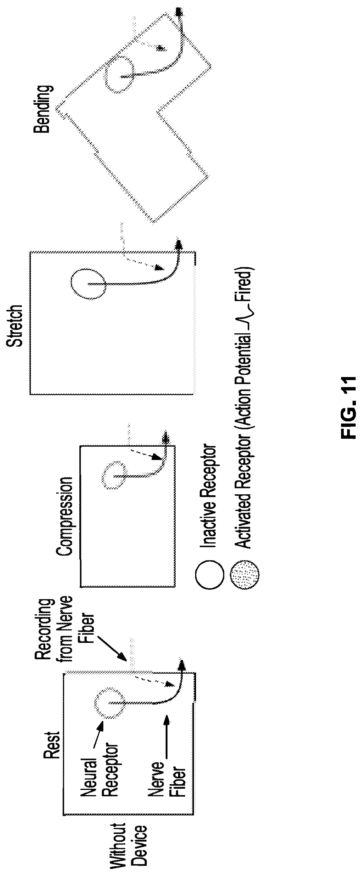 Patent US12310914 Figure 13 – Method and system of mechanical nerve stimulation for pain relief