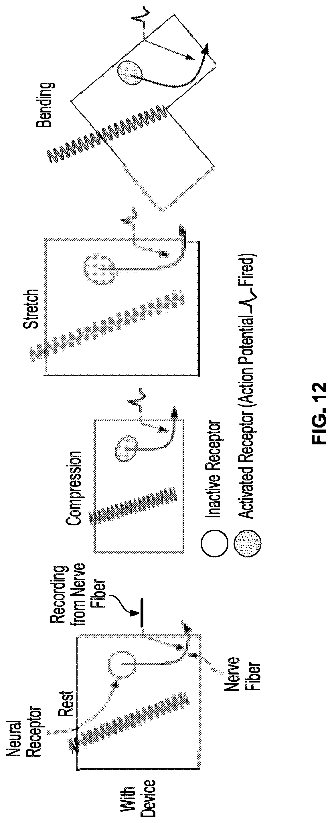 Patent US12310914 Figure 14 – Method and system of mechanical nerve stimulation for pain relief