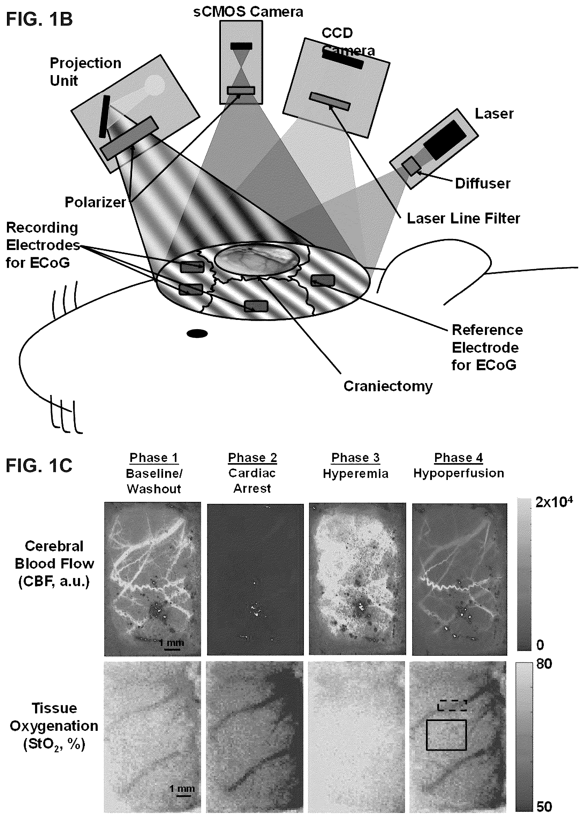Patent US12310916 Figure 2 – Real-time methods to enable precision-guided CPR to improve neurological outcome and predict brain damage after ischemic injury and reperfusion