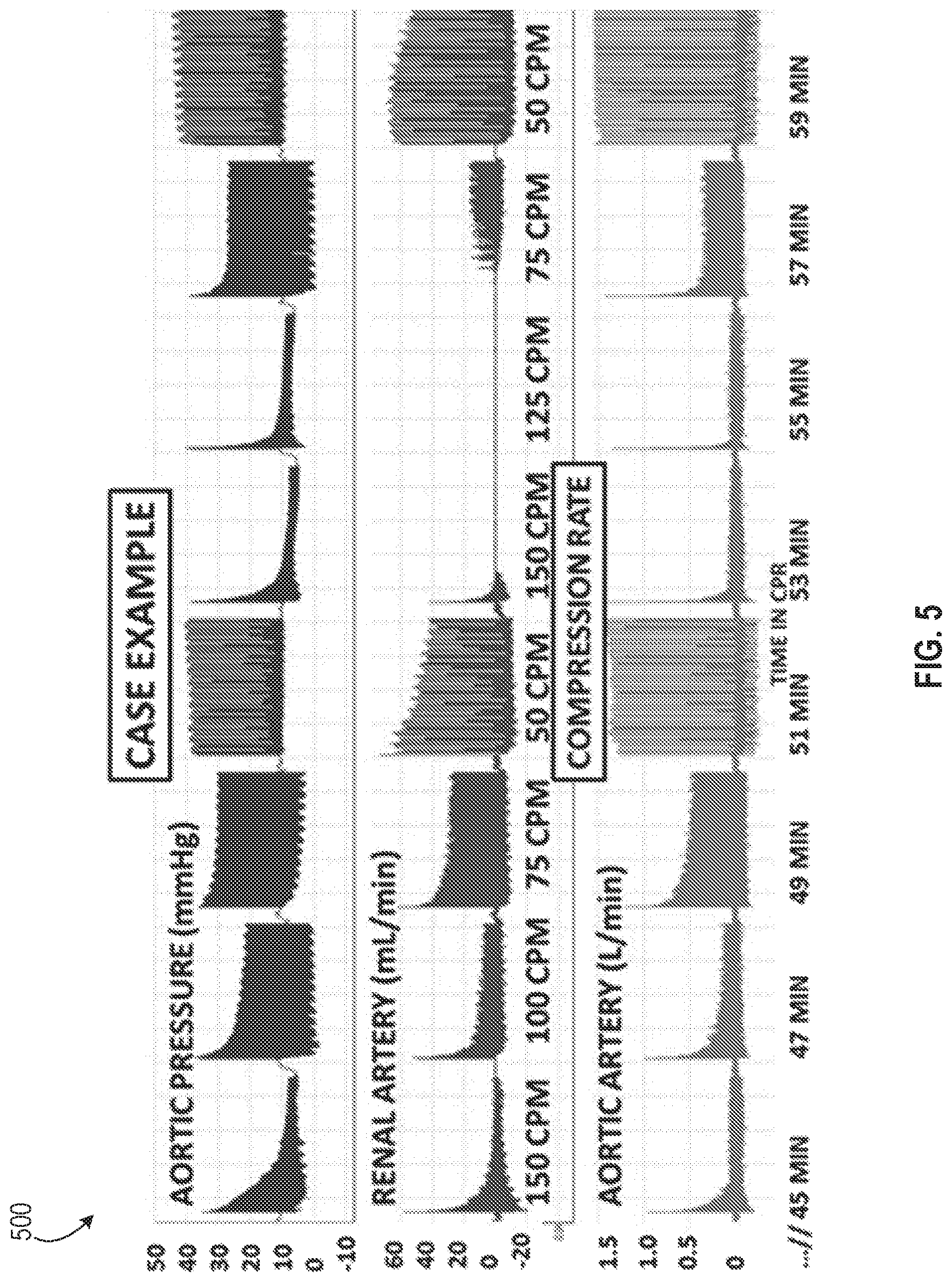 Patent US12310917 Figure 5 – Assisting a CPR treatment