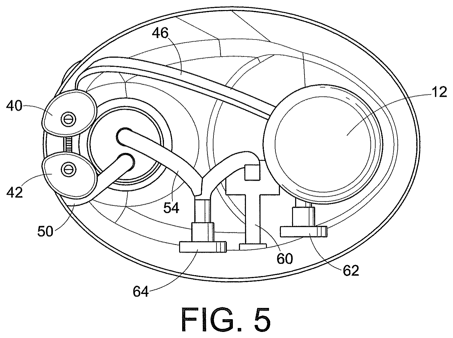 Patent US12310918 Figure 5 – Systems and methods for nasal irrigation