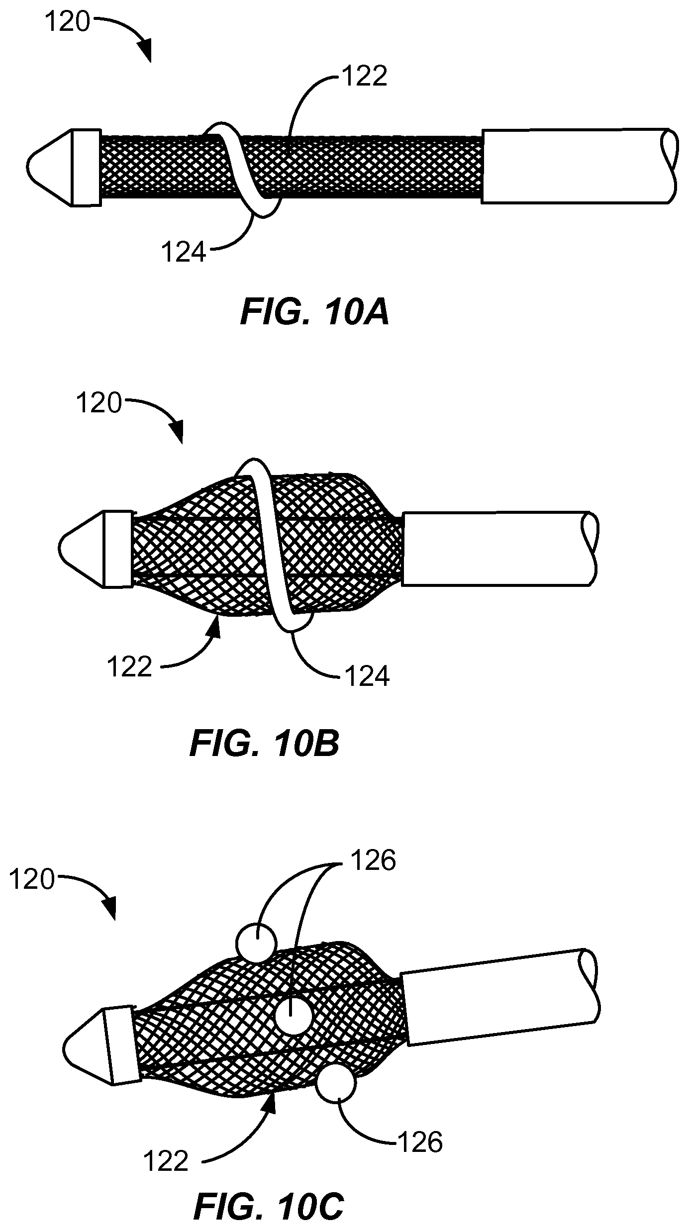 Patent US12310927 Figure 11 – Methods and systems for ablation of the renal pelvis