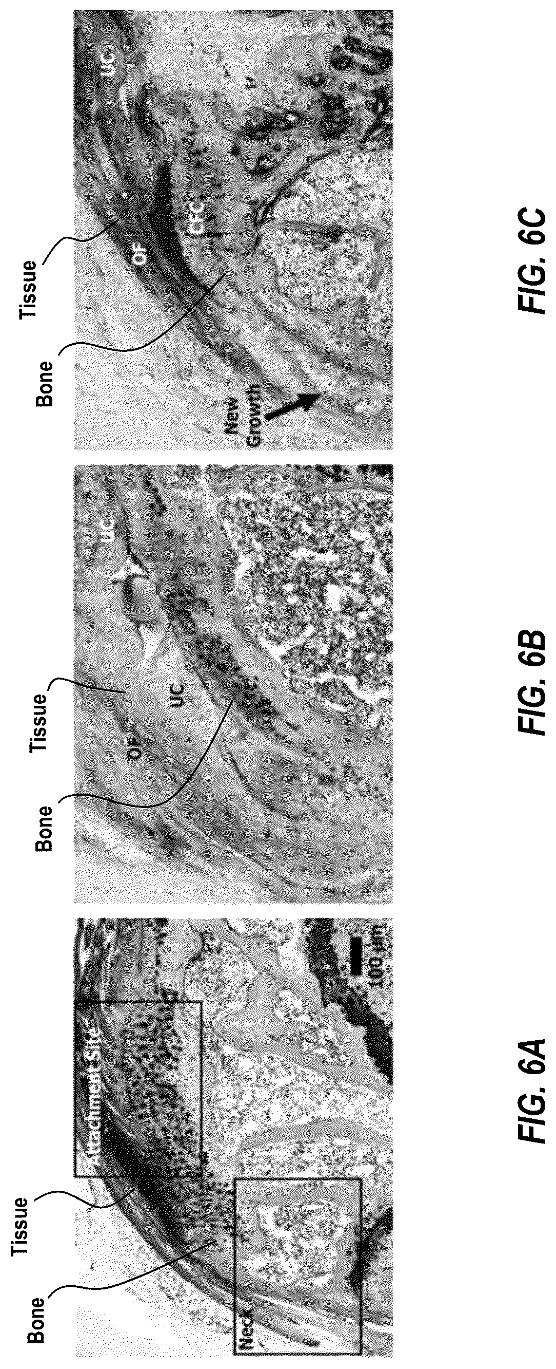 Patent US12310928 Figure 7 – Enthesis healing