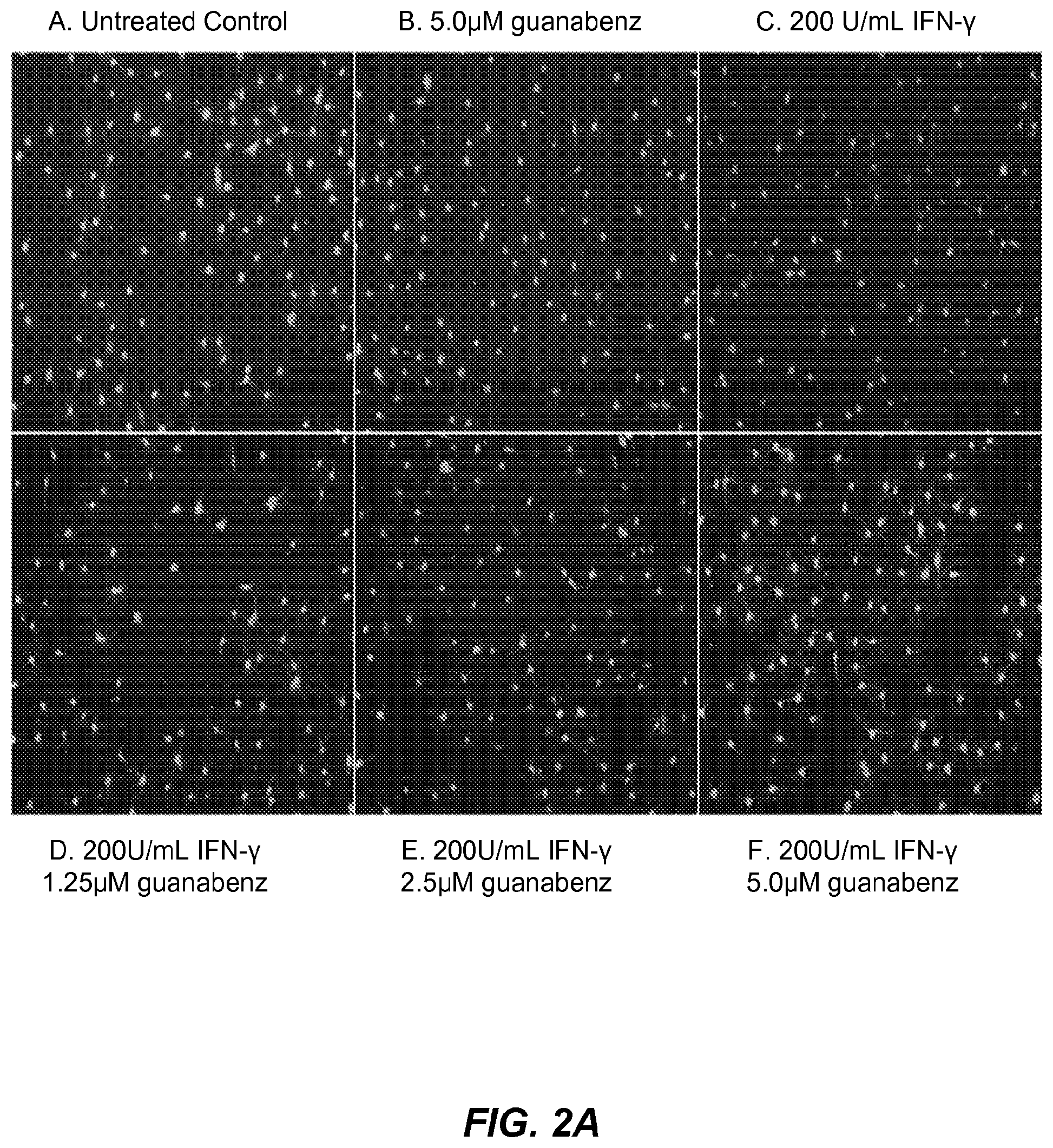 Patent US12310933 Figure 2 – Treatment of demyelinating disorders