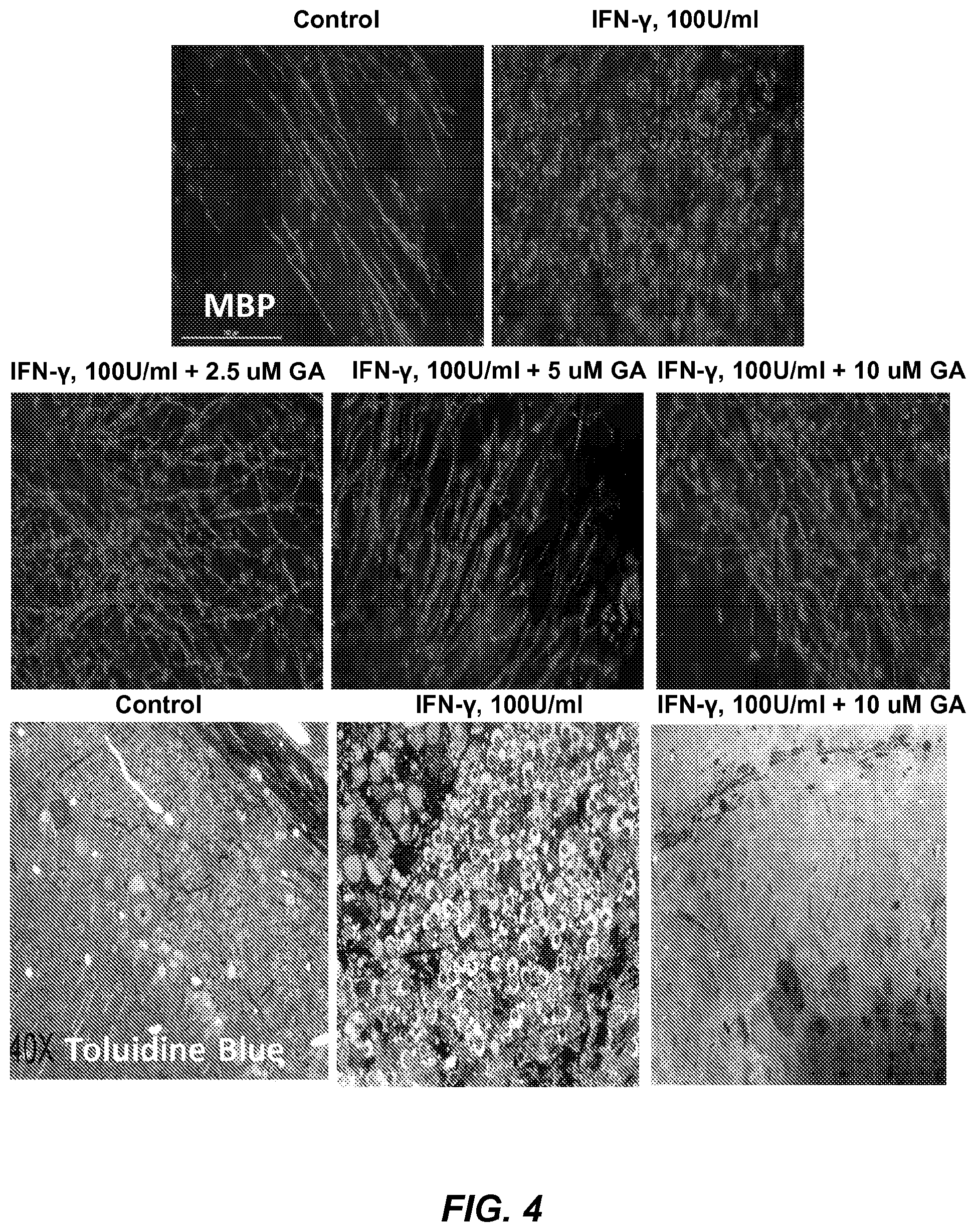 Patent US12310933 Figure 6 – Treatment of demyelinating disorders