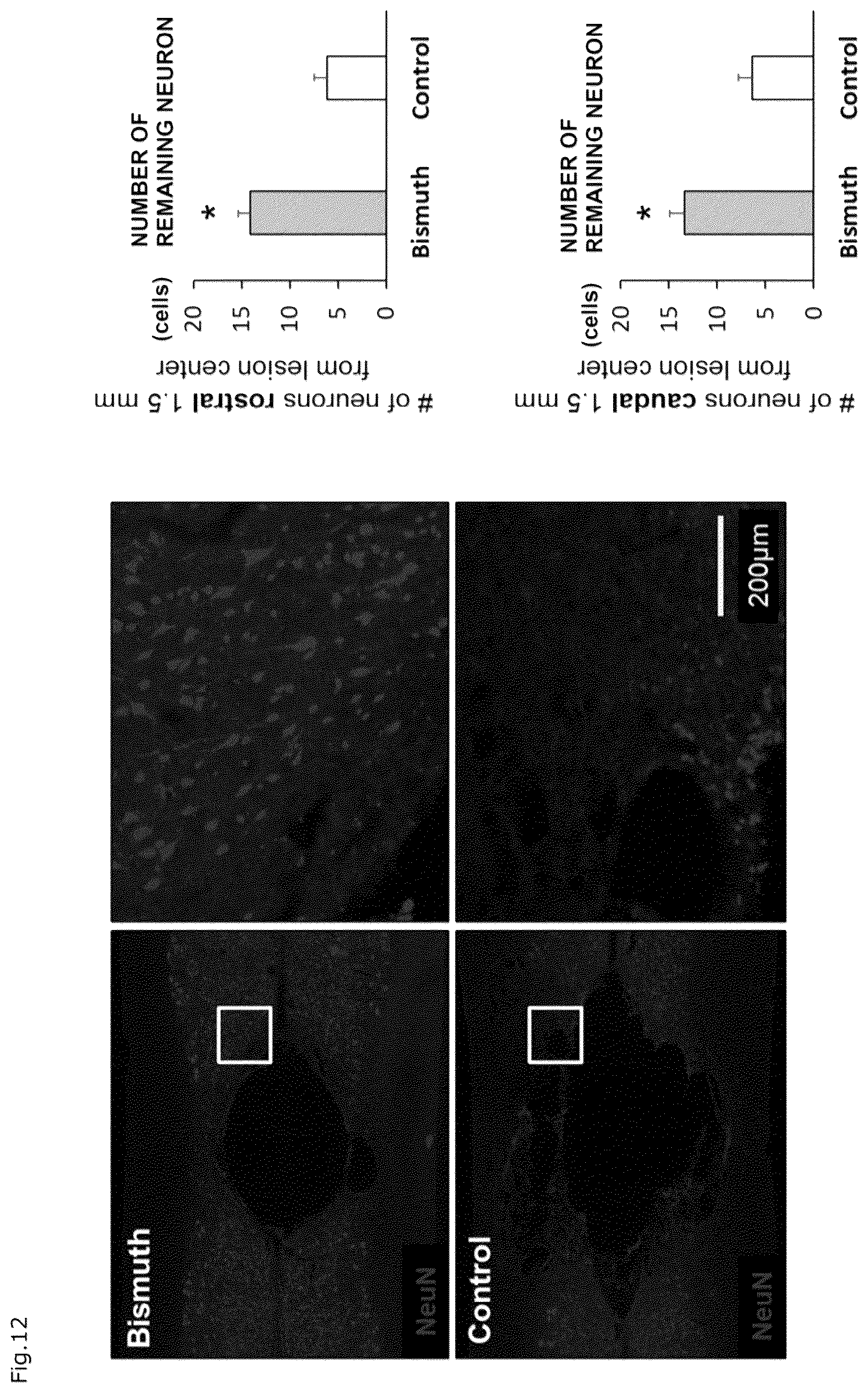 Patent US12310941 Figure 9 – Agent for protection of blood brain spinal cord barrier